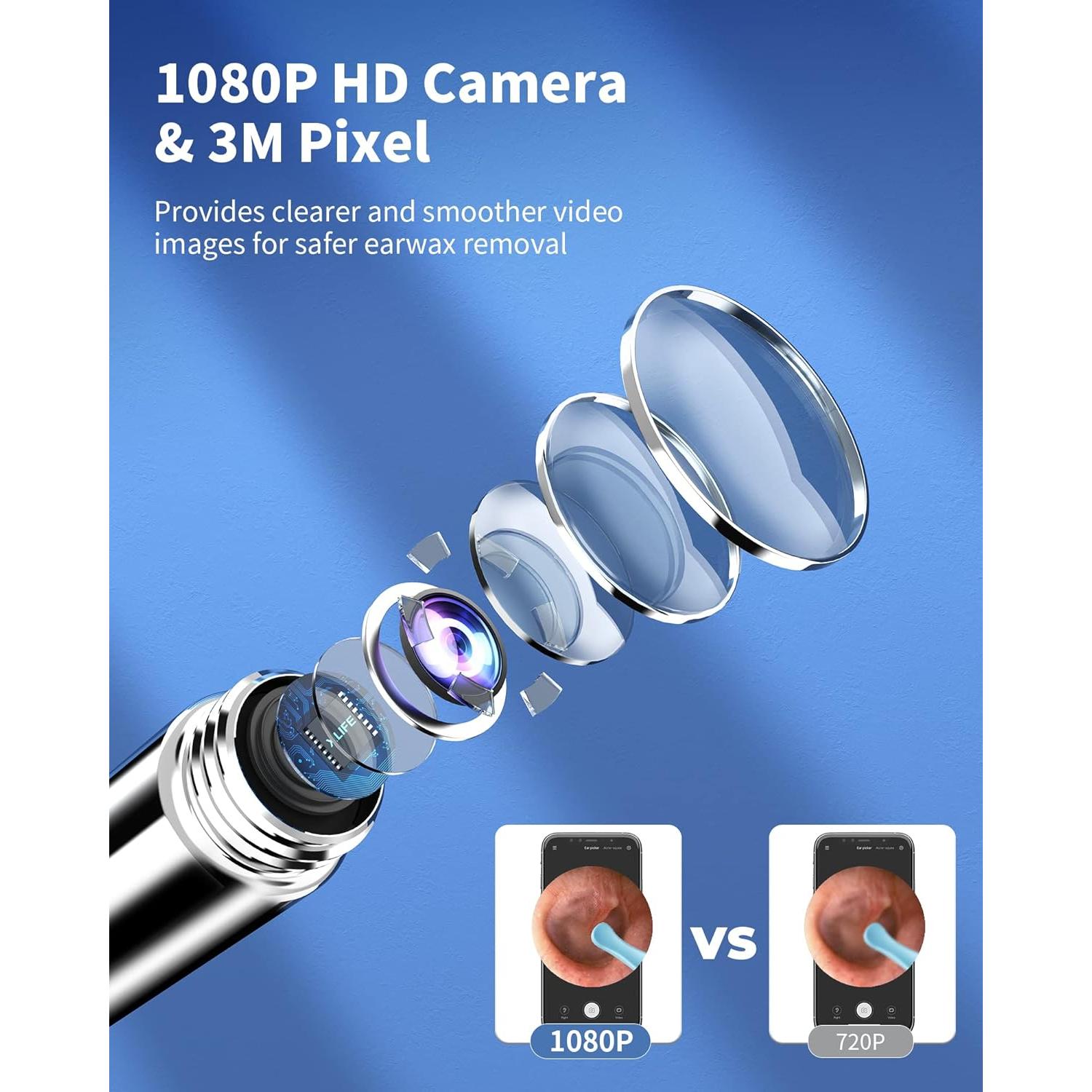 Limpiador de Oídos Yumika X1 con Cámara HD 1080P 7 Piezas