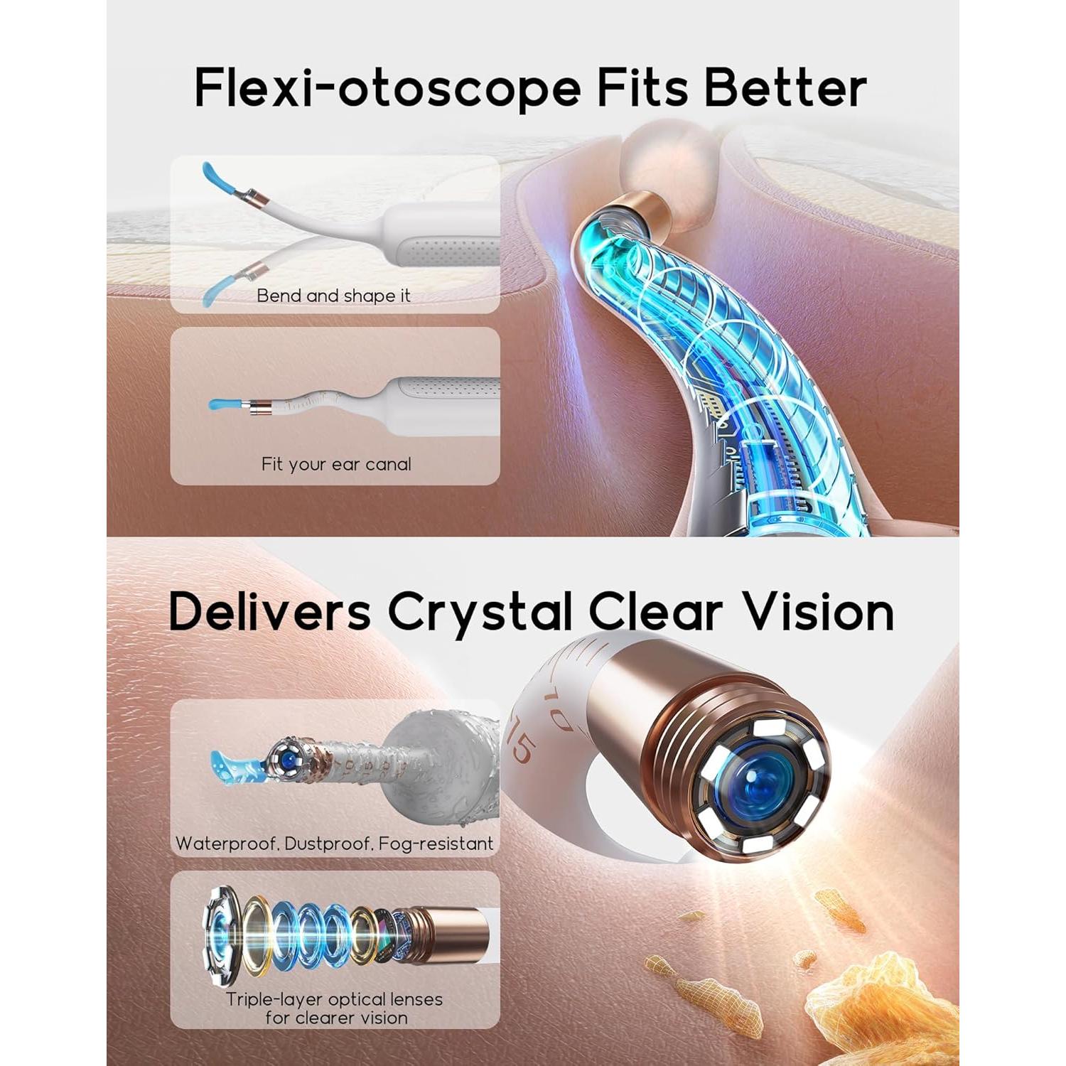 Bebird Earsight Plus R37R Kit Limpieza Oídos Cámara HD