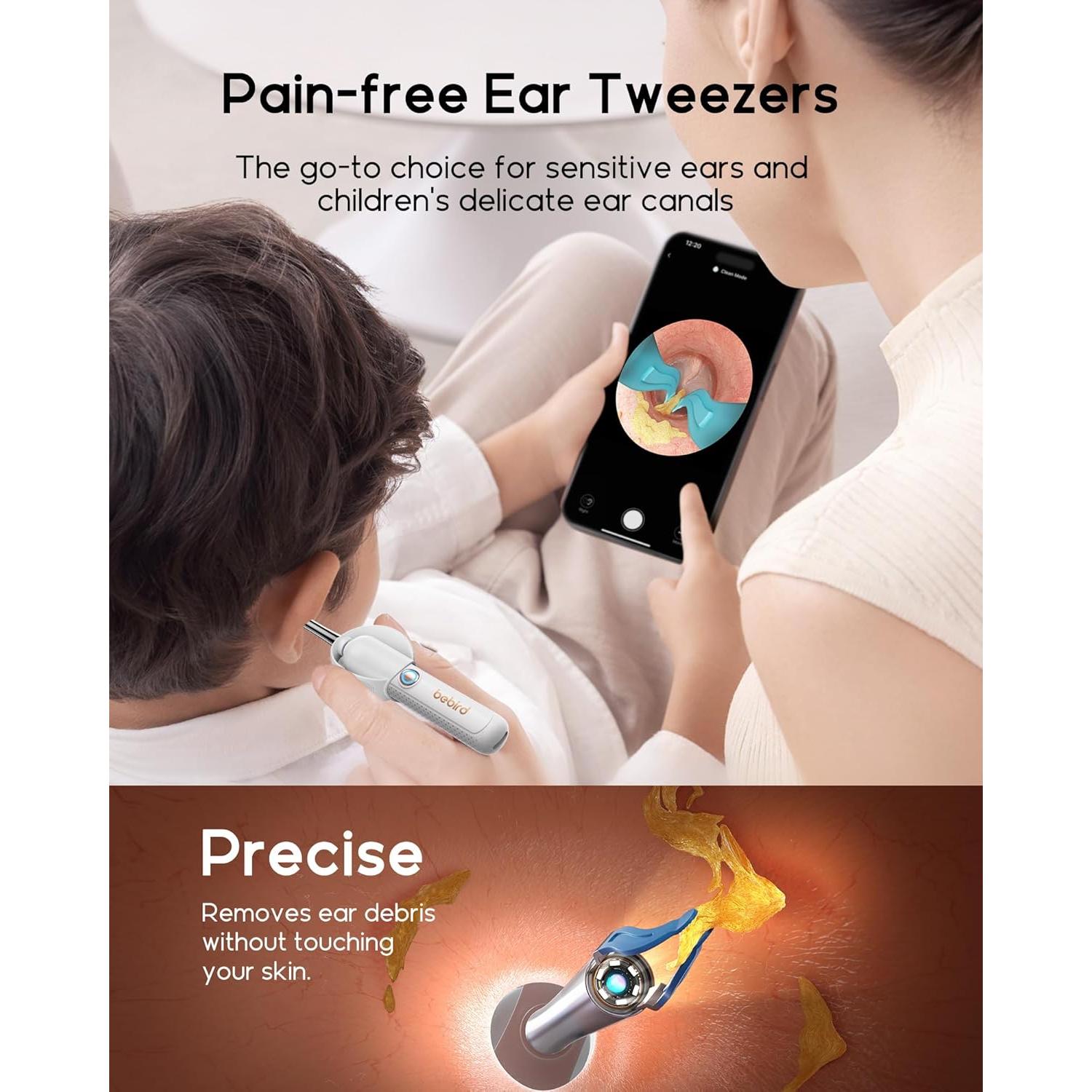 Bebird Earsight Plus R37R Kit Limpieza Oídos Cámara HD