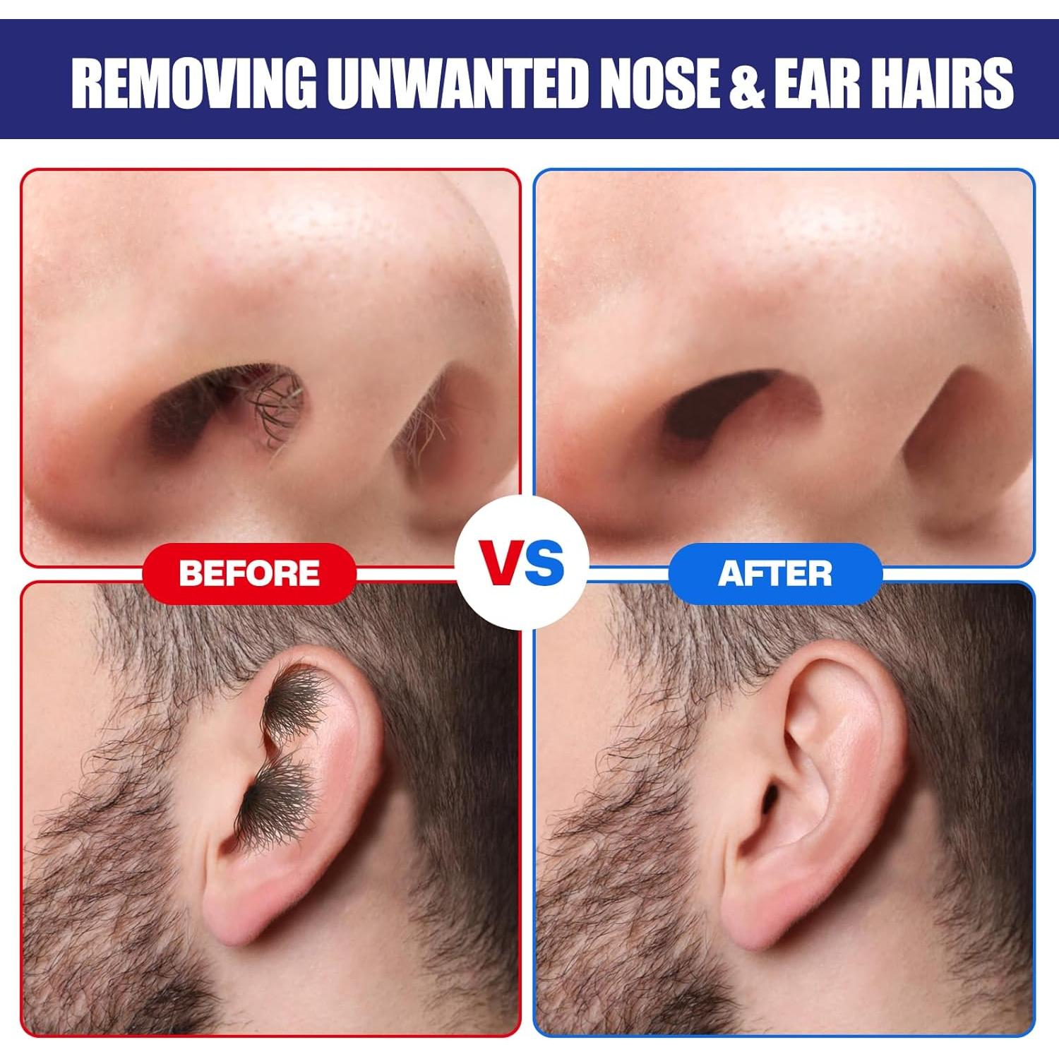 Kit de Cera para Nariz y Oídos Reni 120 g - 30 Aplicadores