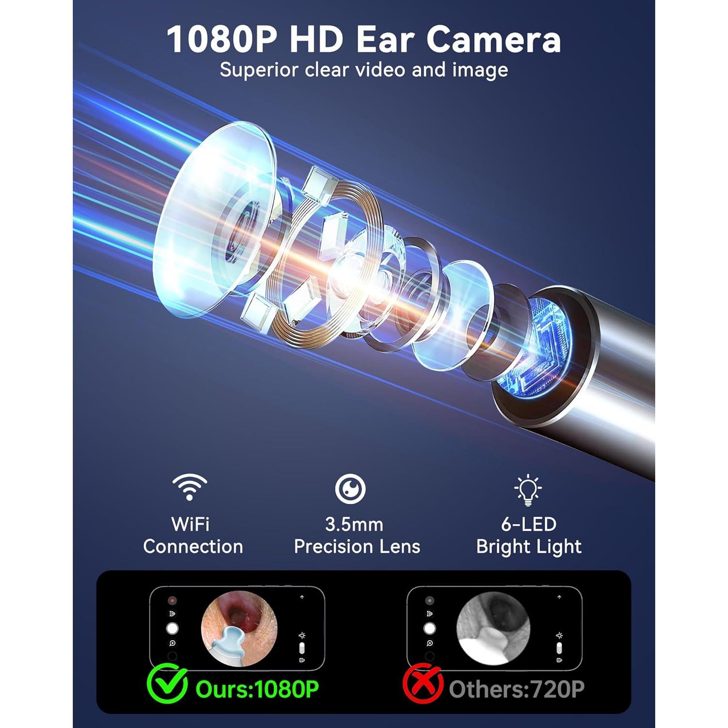 Limpiador de Oídos Jegoat con Cámara HD 1080P y 6 LED