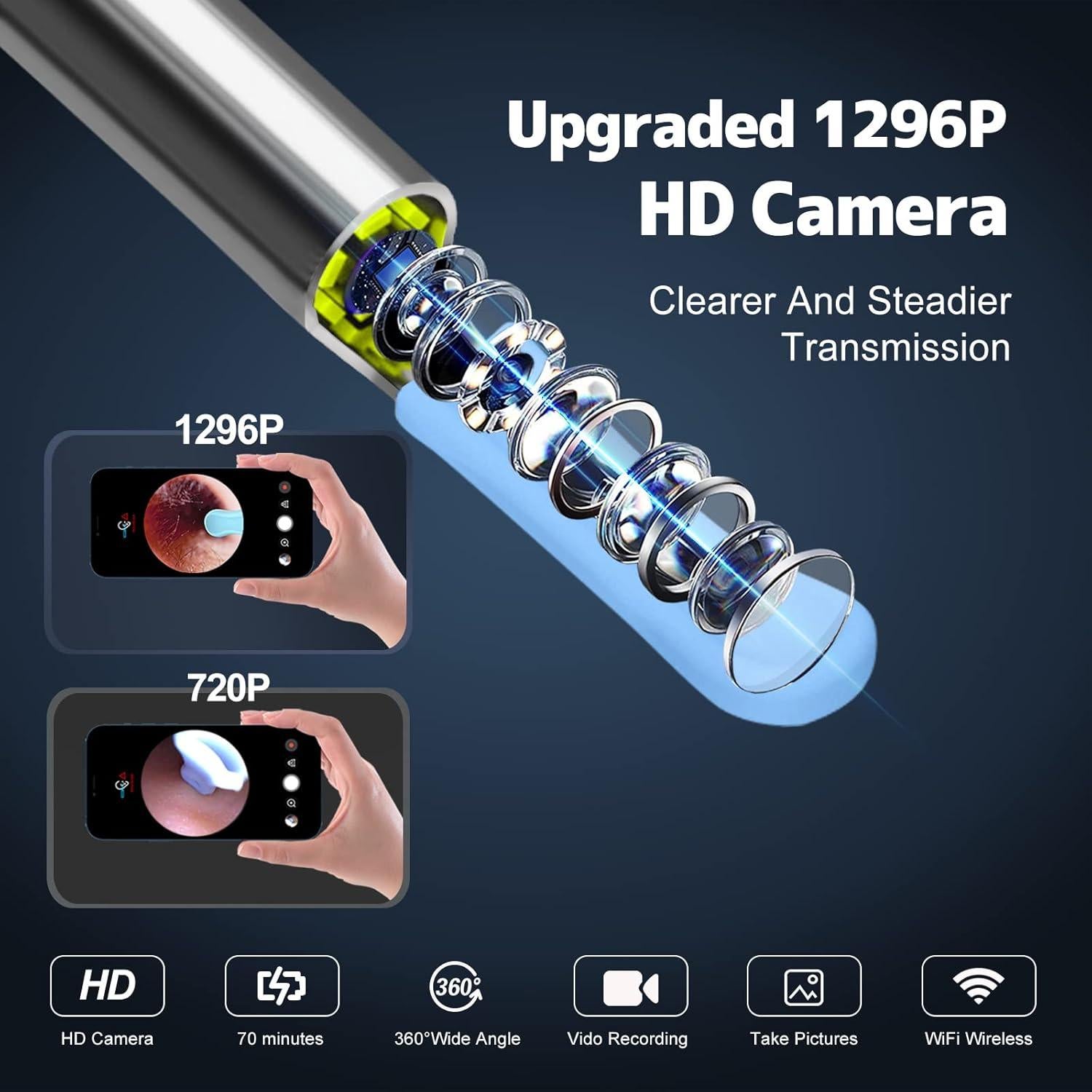 Limpiador de Oídos Nyotall con Cámara 1296P y Luz LED