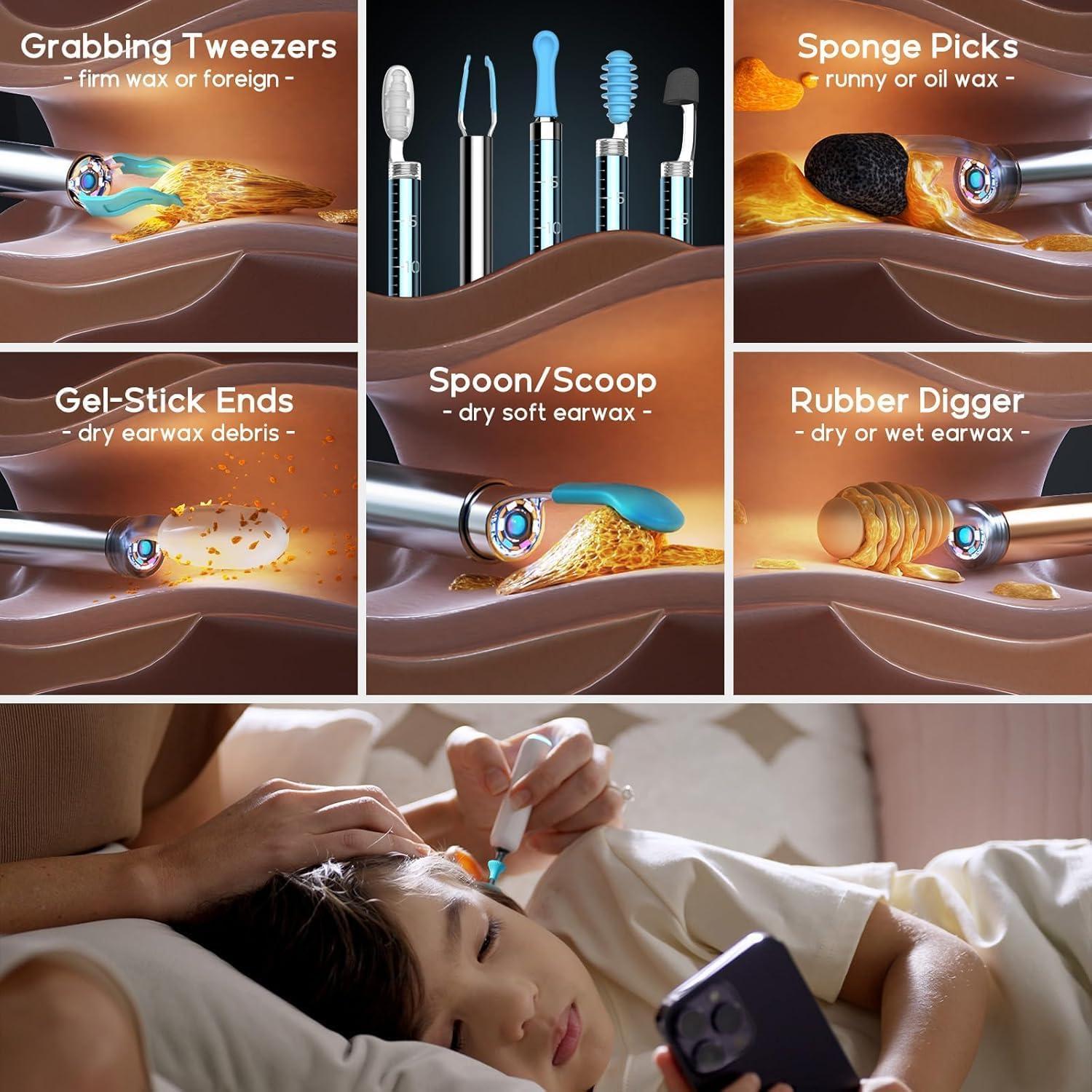 Bebird H30 Kit de Limpieza de Oído con Cámara y Luz LED