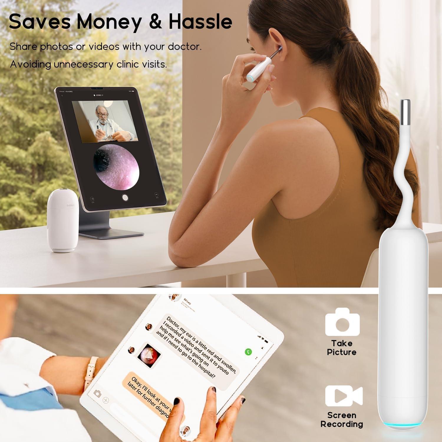 Bebird H30 Kit de Limpieza de Oído con Cámara y Luz LED