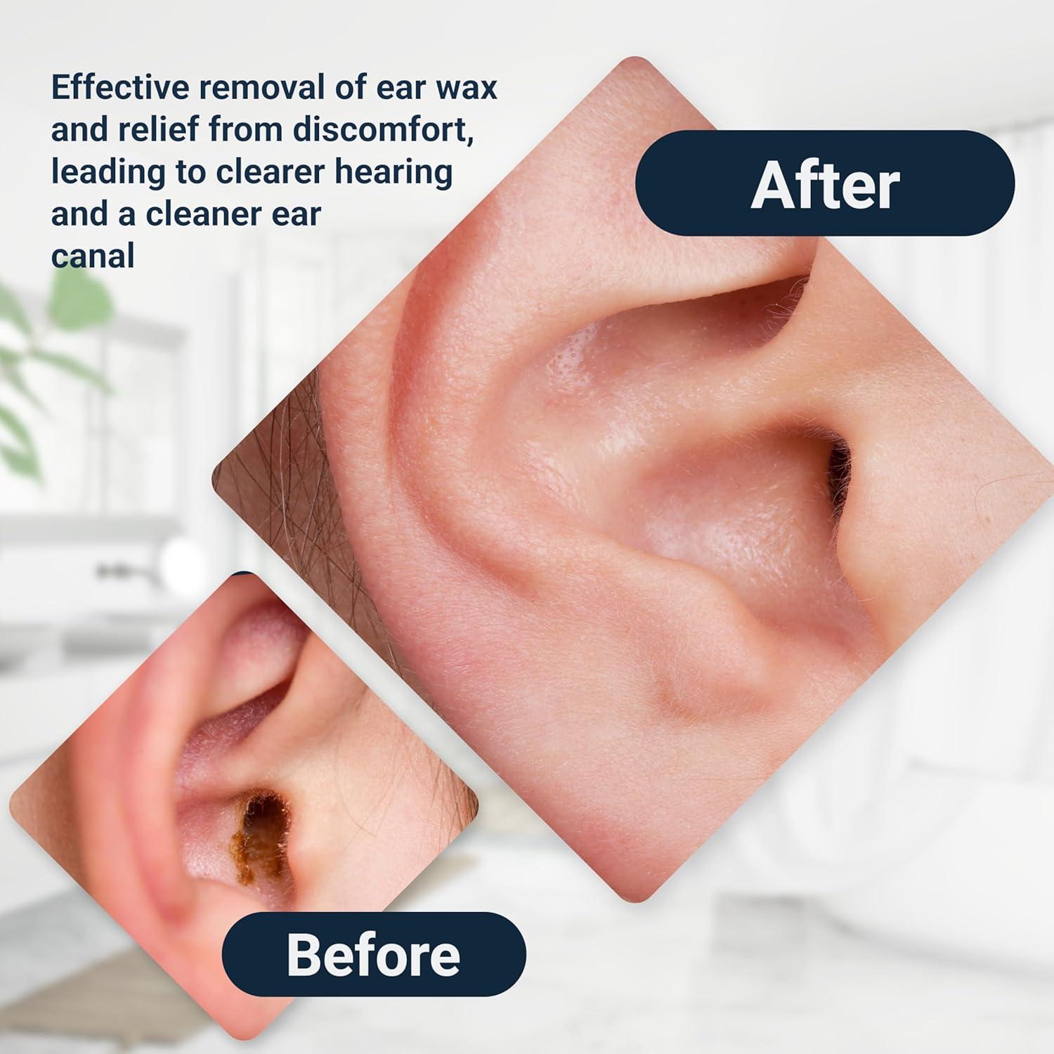 Botella Lavadora de Oídos Doctor Easy - Limpieza Profesional