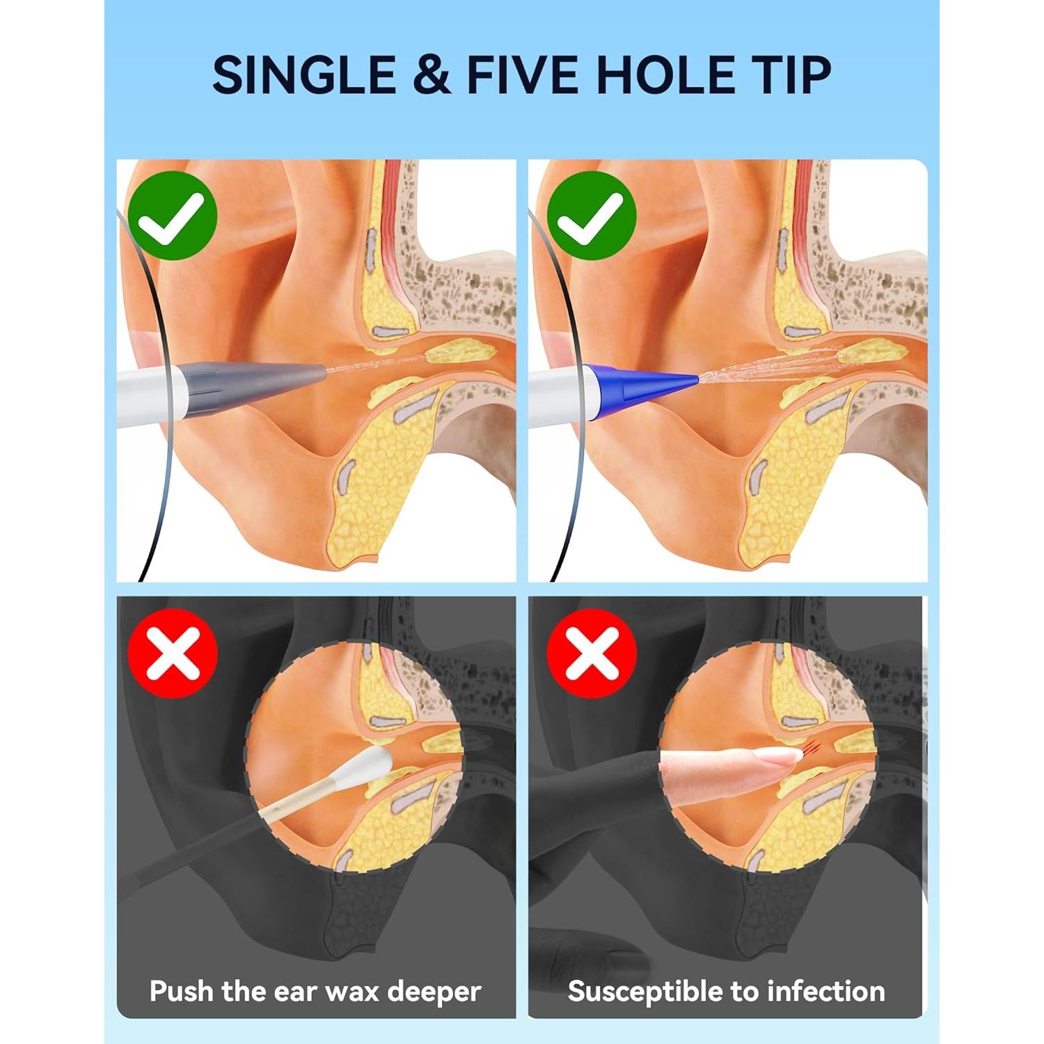 Limpiador de Oído Eléctrico KAUGIC con Cámara 1080P y 10 Puntas
