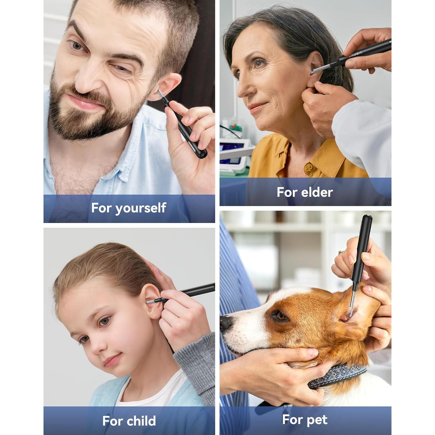 Limpiador de Oído Eléctrico KAUGIC con Cámara 1080P y 10 Puntas