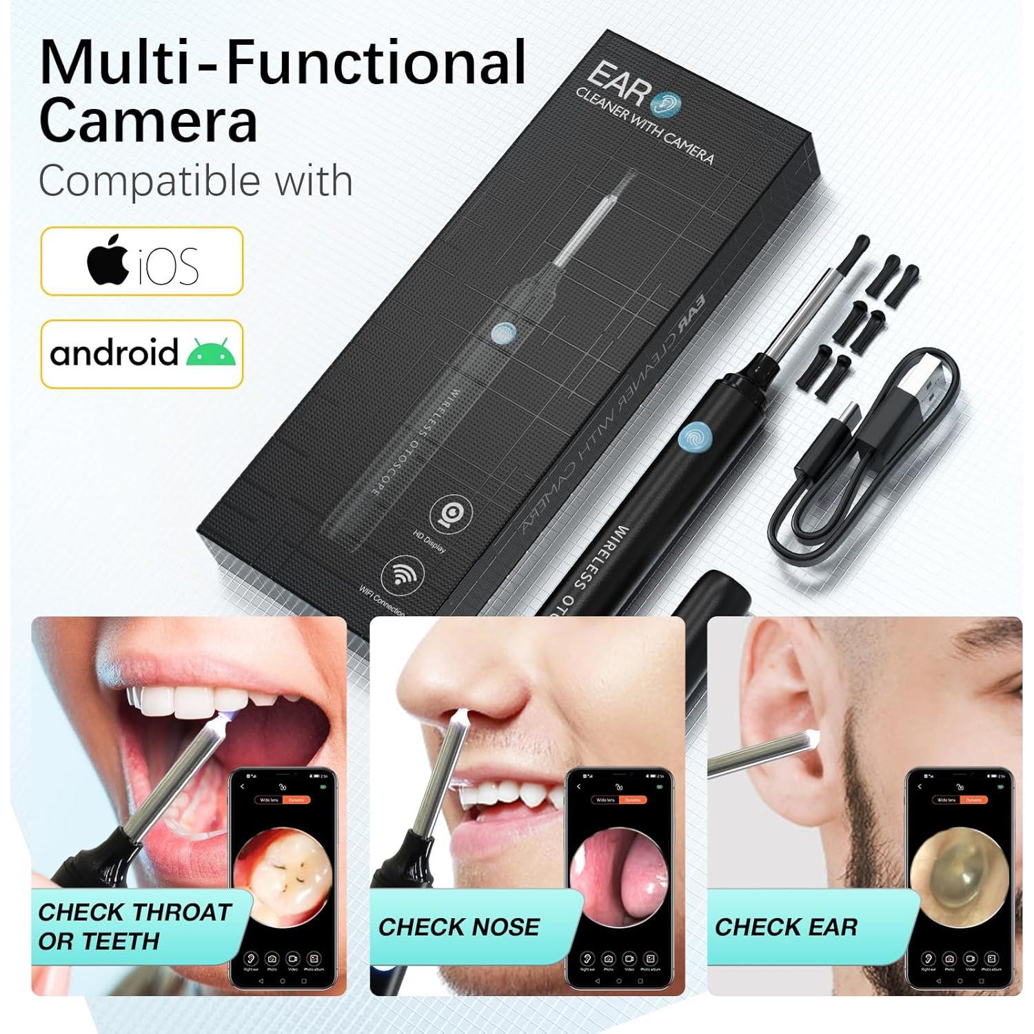 Limpiador de Oídos KARU AETO con Cámara 1080P y 4 Modos