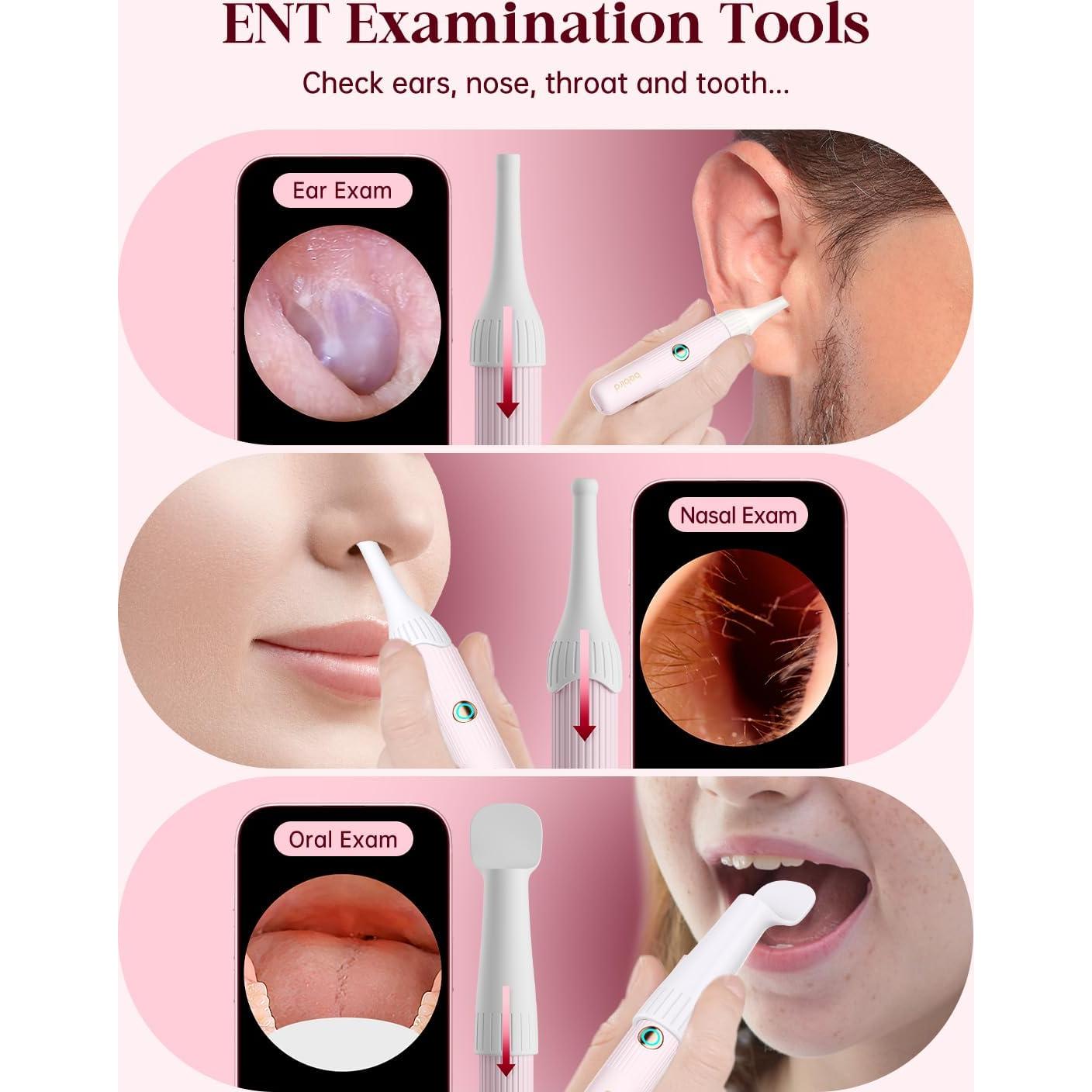 Kit de Limpieza de Oídos Heifeng Rosa con Cámara HD