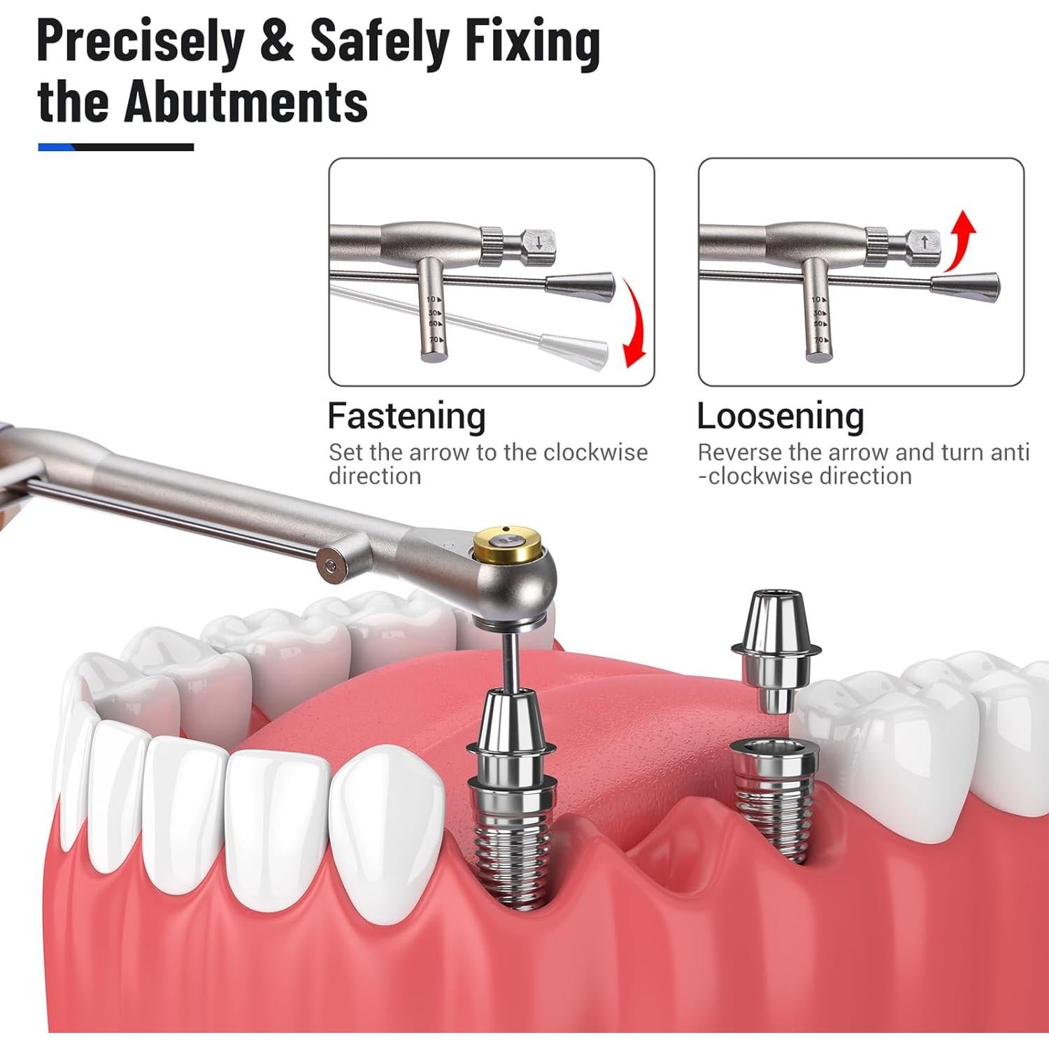 Juego de Llave de Torque 4E's para Implantes Dentales 16pcs