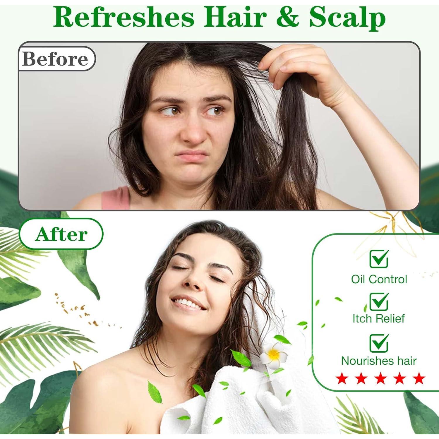 Gorros de Shampoo Sin Enjuague BestLink - Paquete de 6