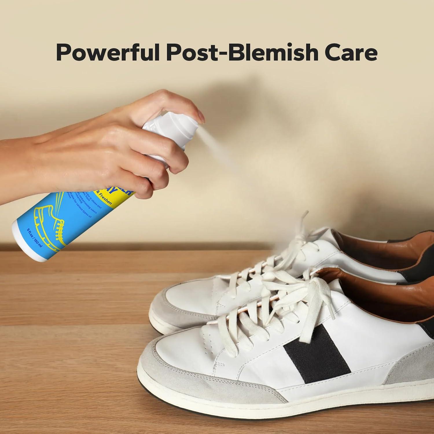 Desodorante para Zapatos Choppie 148 ml Eliminador Olores