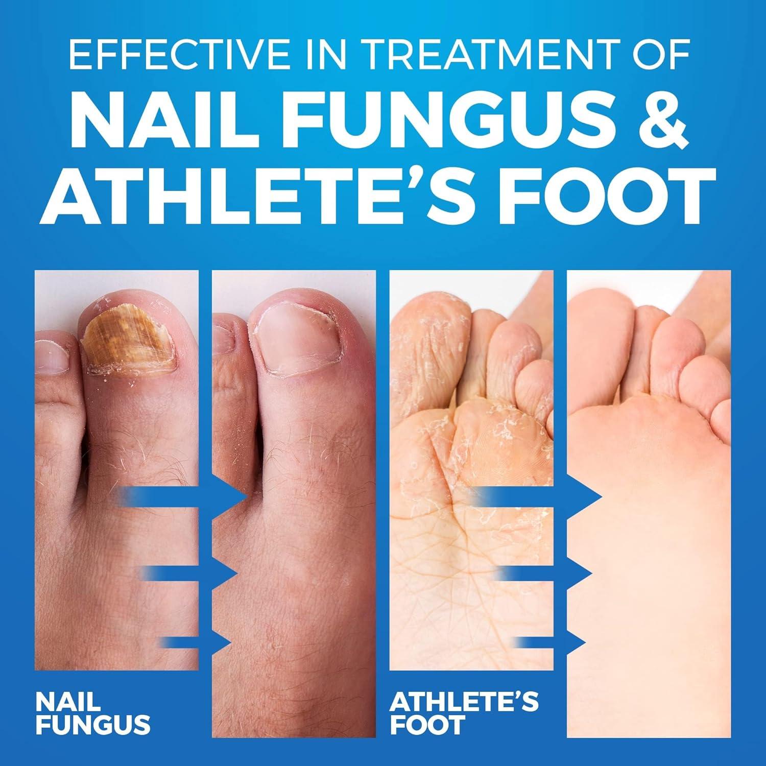 Spray Desodorante para Pies y Zapatos Imperial Feet 150ml