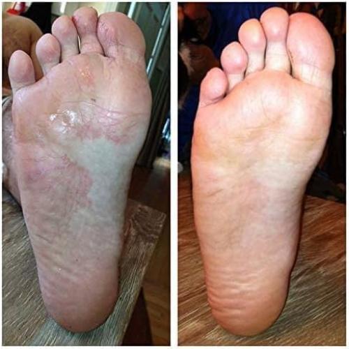 Spray Desodorante para Pies y Zapatos Imperial Feet 150ml