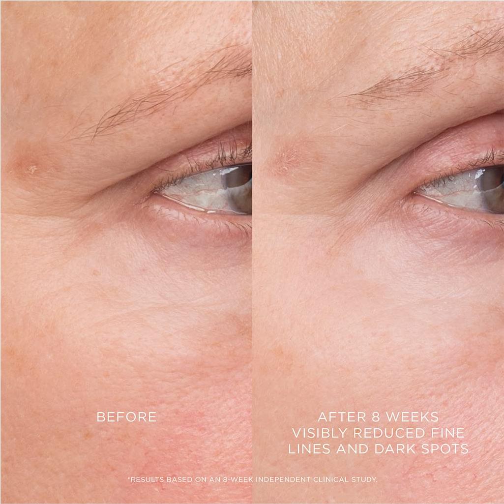 Tratamiento Retinoides Resurfacing Hourglass 12,06x3,61cm