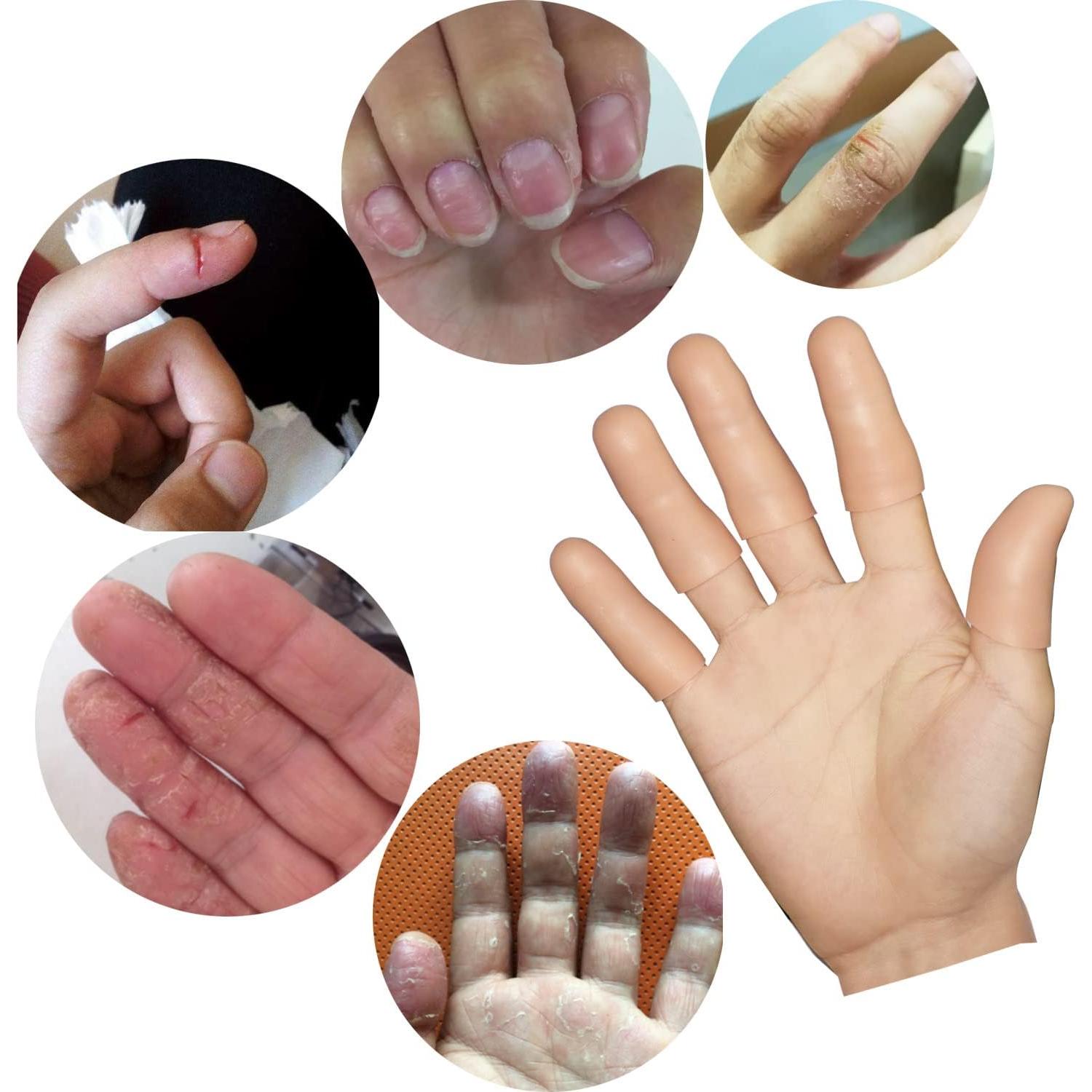 Fundas de Dedos de Gel YIVCKOM - 20 Piezas para Eccema y Artritis