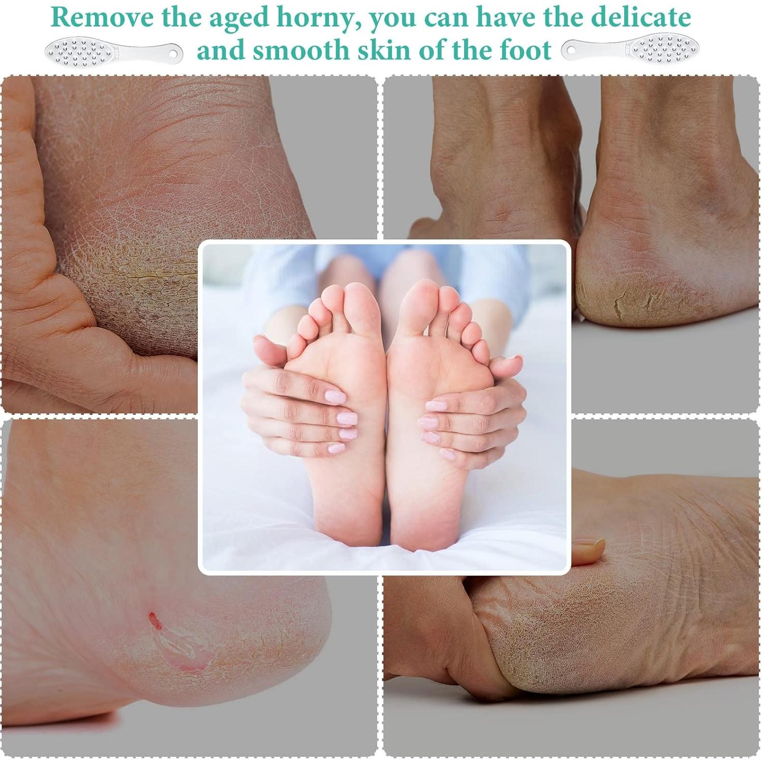 Raspador de Pies Jutom Acero Inoxidable 2 Piezas Lima Doble Cara