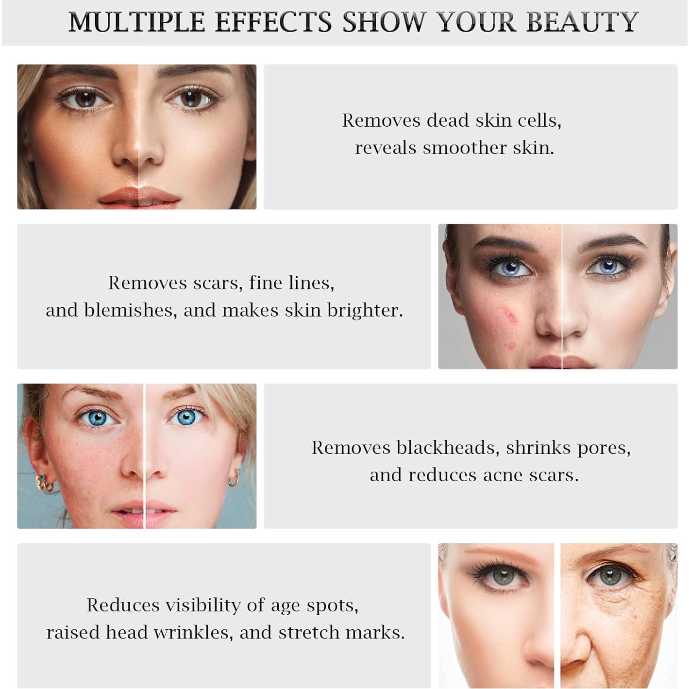 Máquina de Microdermoabrasión Diamante AIMENGXI 3 en 1