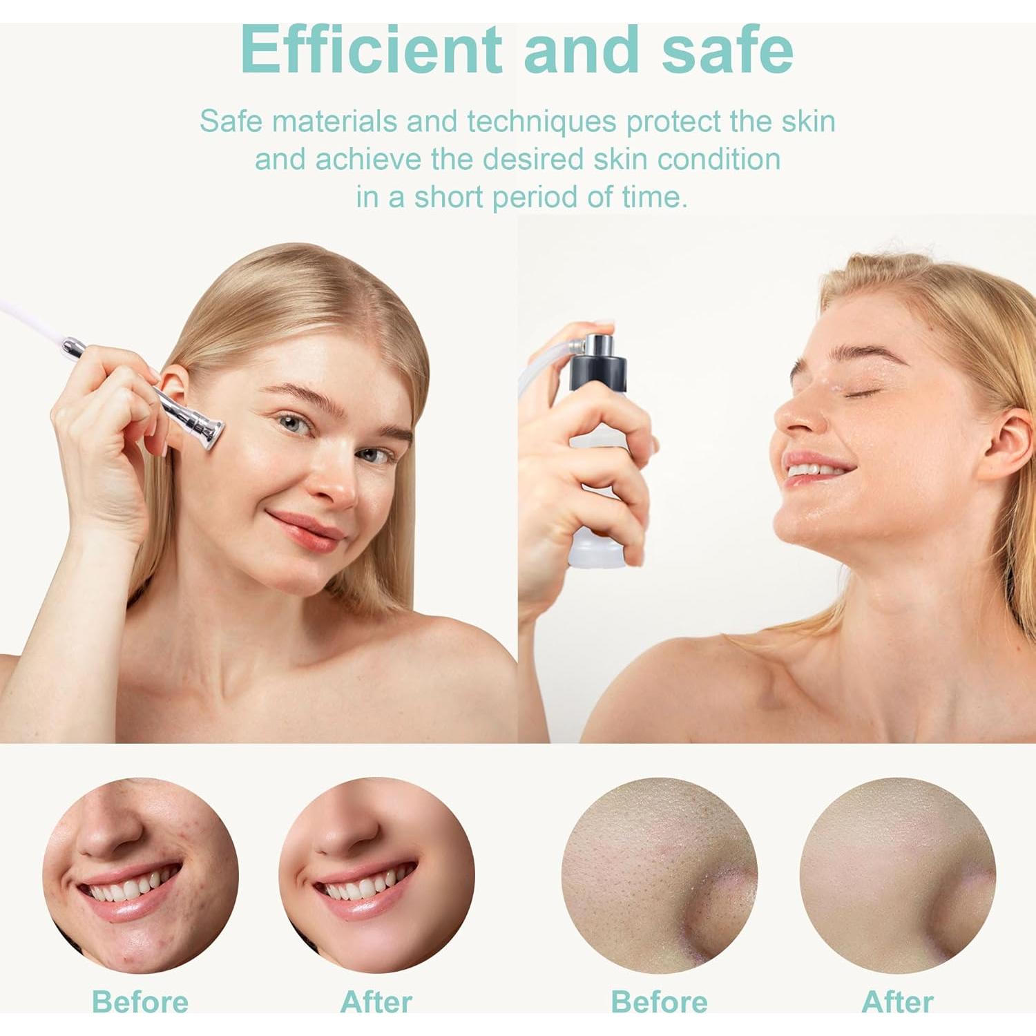 Máquina de Microdermoabrasión Kendal PWSF02 con Spray Facial