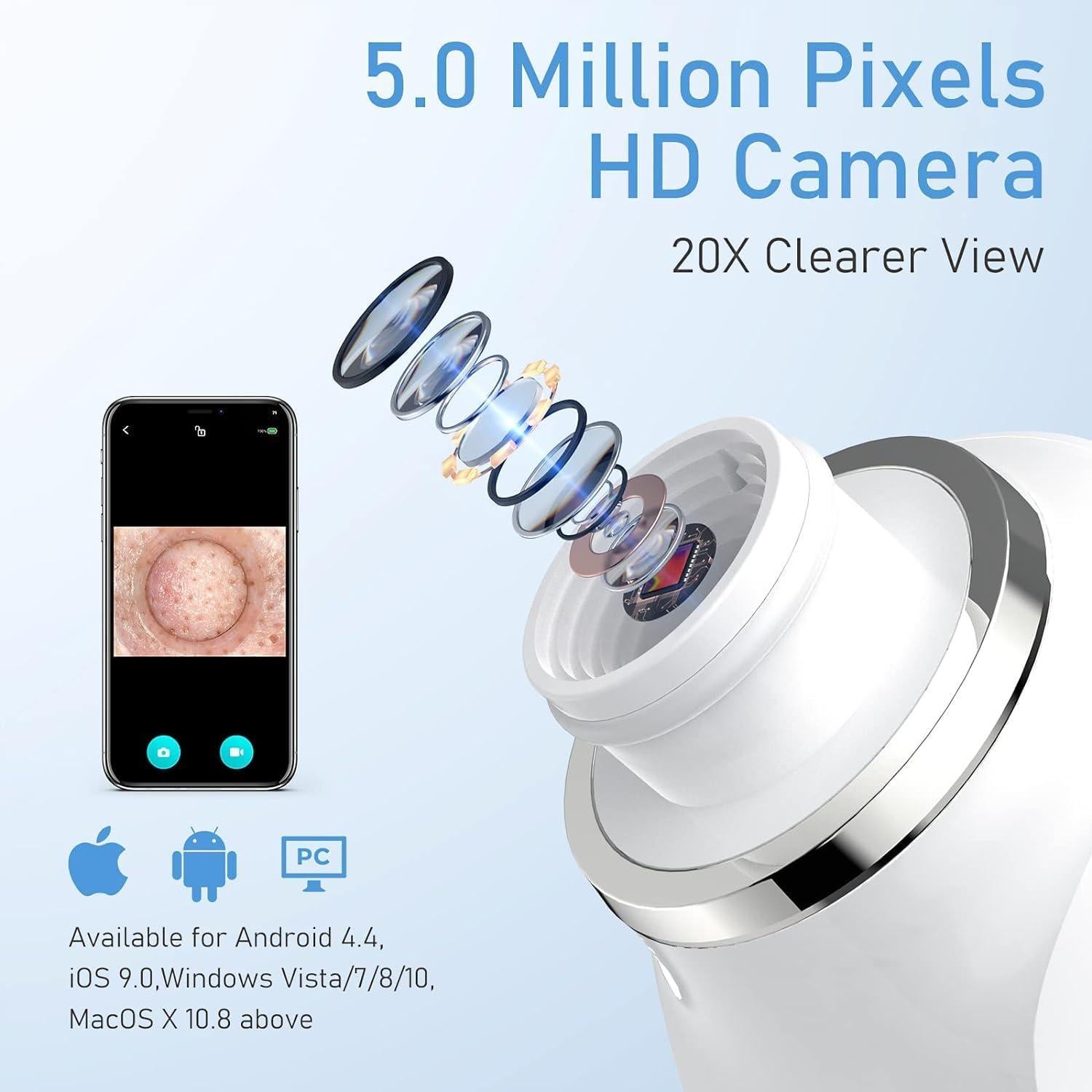 Aspiradora de Puntos Negros Ottleba H200 USB 3 Modos 6 Cabezales