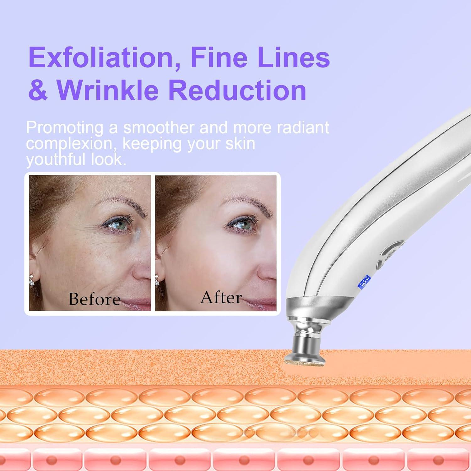 Máquina de Microdermoabrasión Facial Pet Baby 9 Cabezas