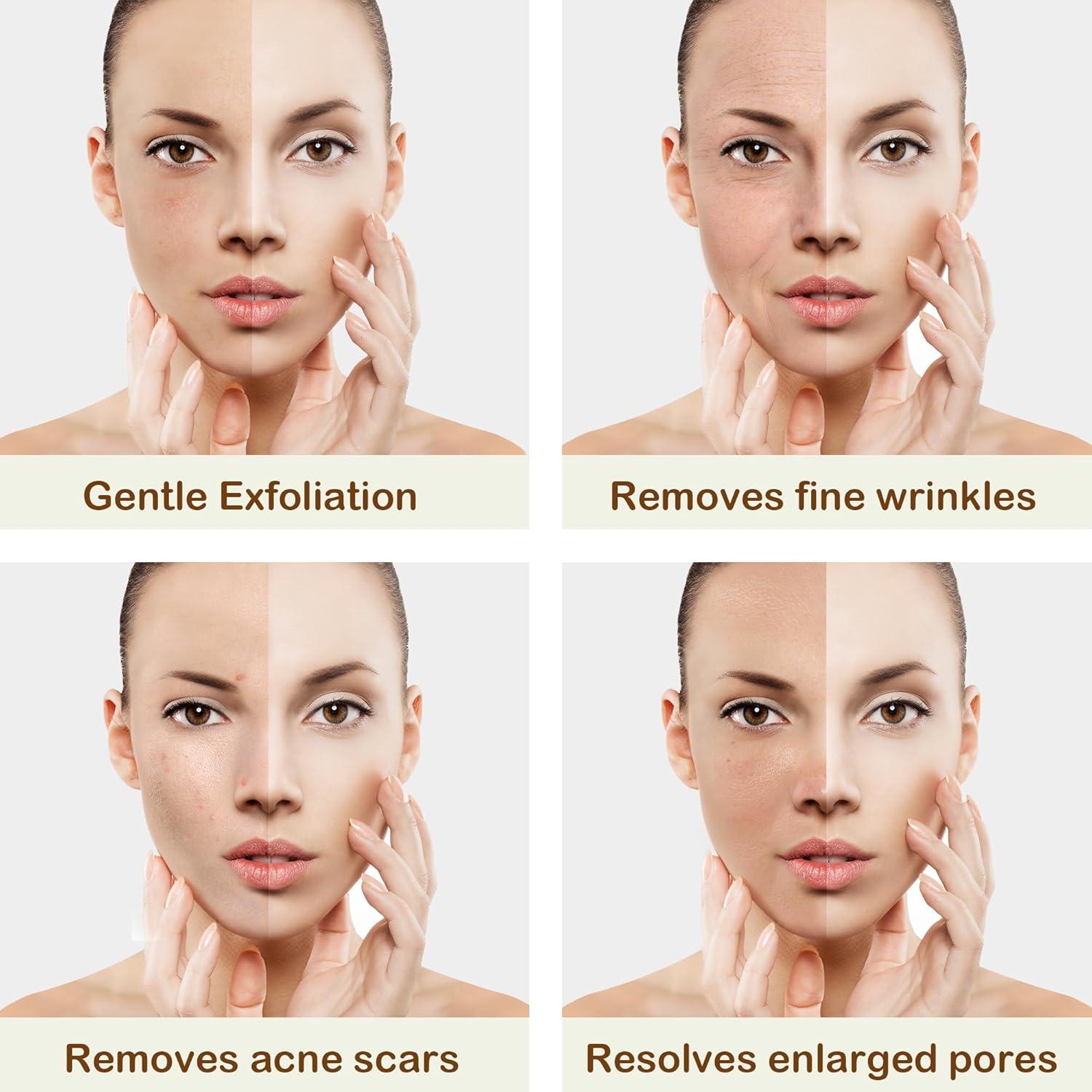 Máquina Profesional de Microdermoabrasión Kendal 3 en 1