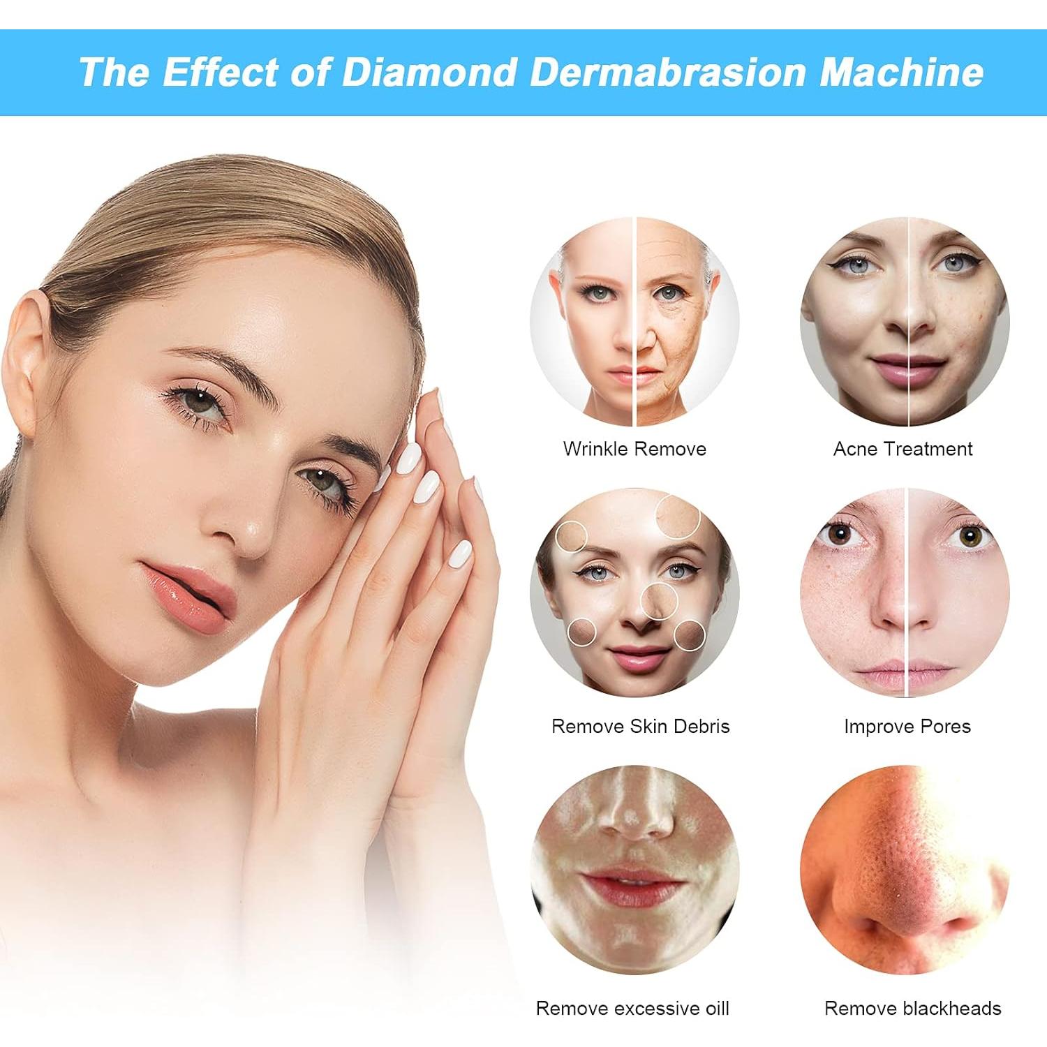 Máquina de Microdermoabrasión Diamante AIMENGXI 2 en 1