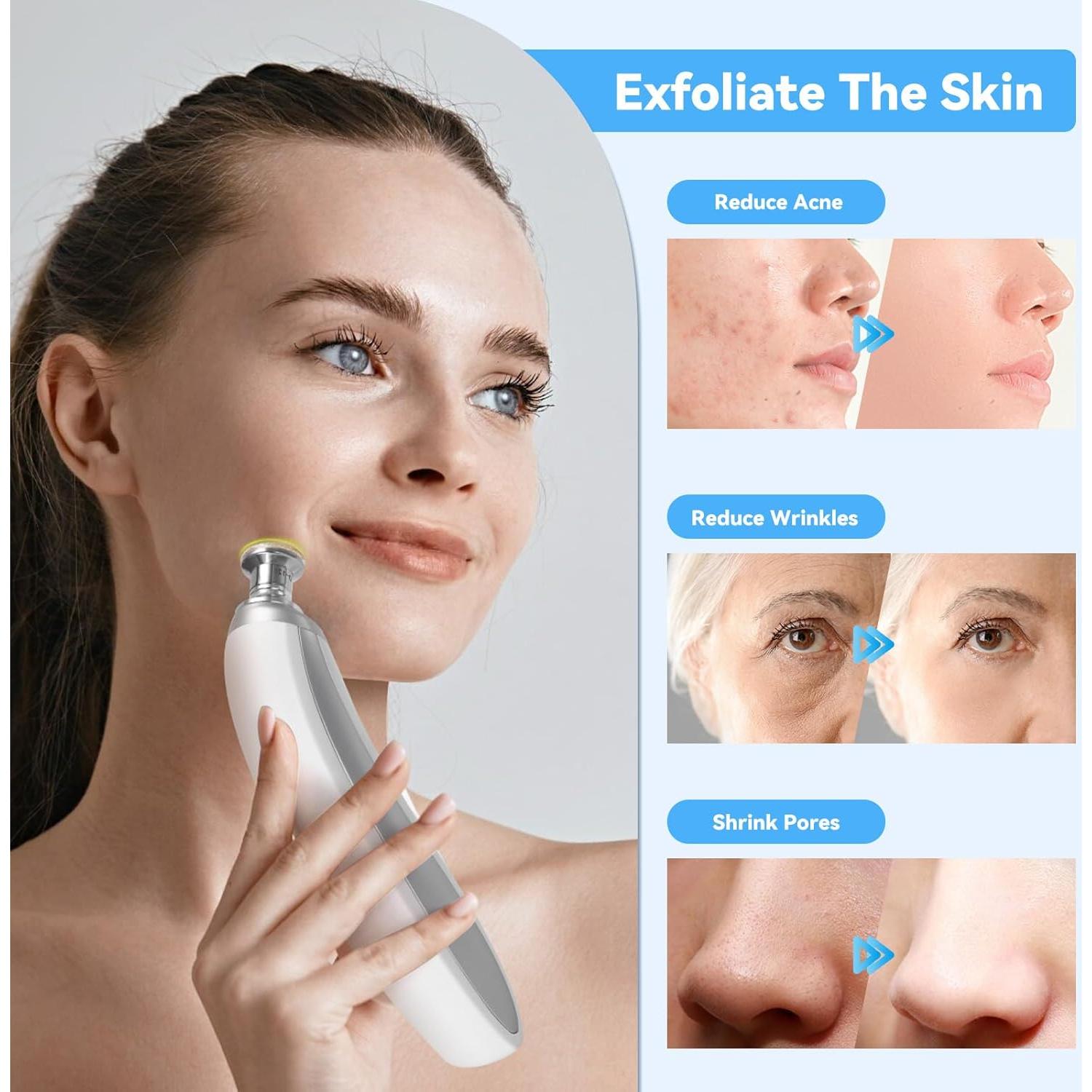 Máquina de Microdermoabrasión Beautycity 112120-10, 9 Cabezas