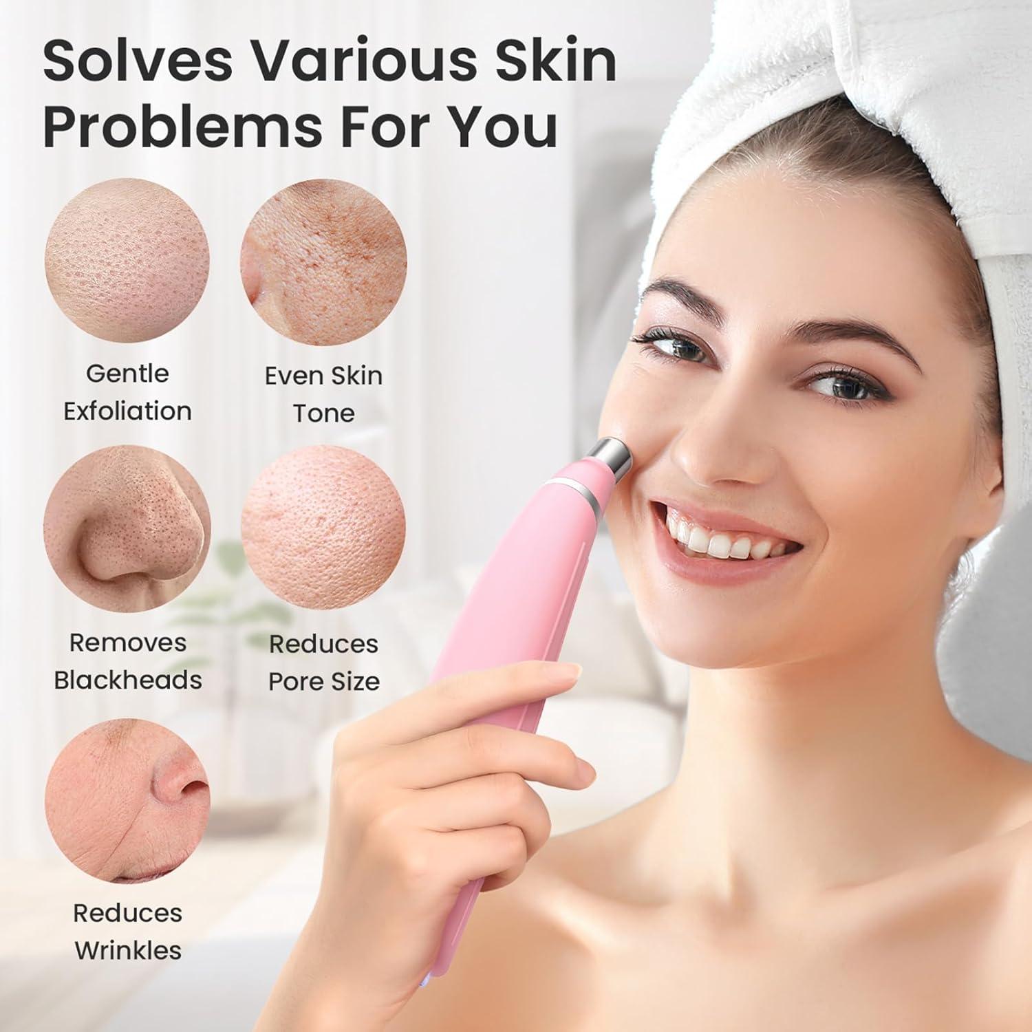 Máquina de Microdermoabrasión UNOISETION Rosa Inalámbrica