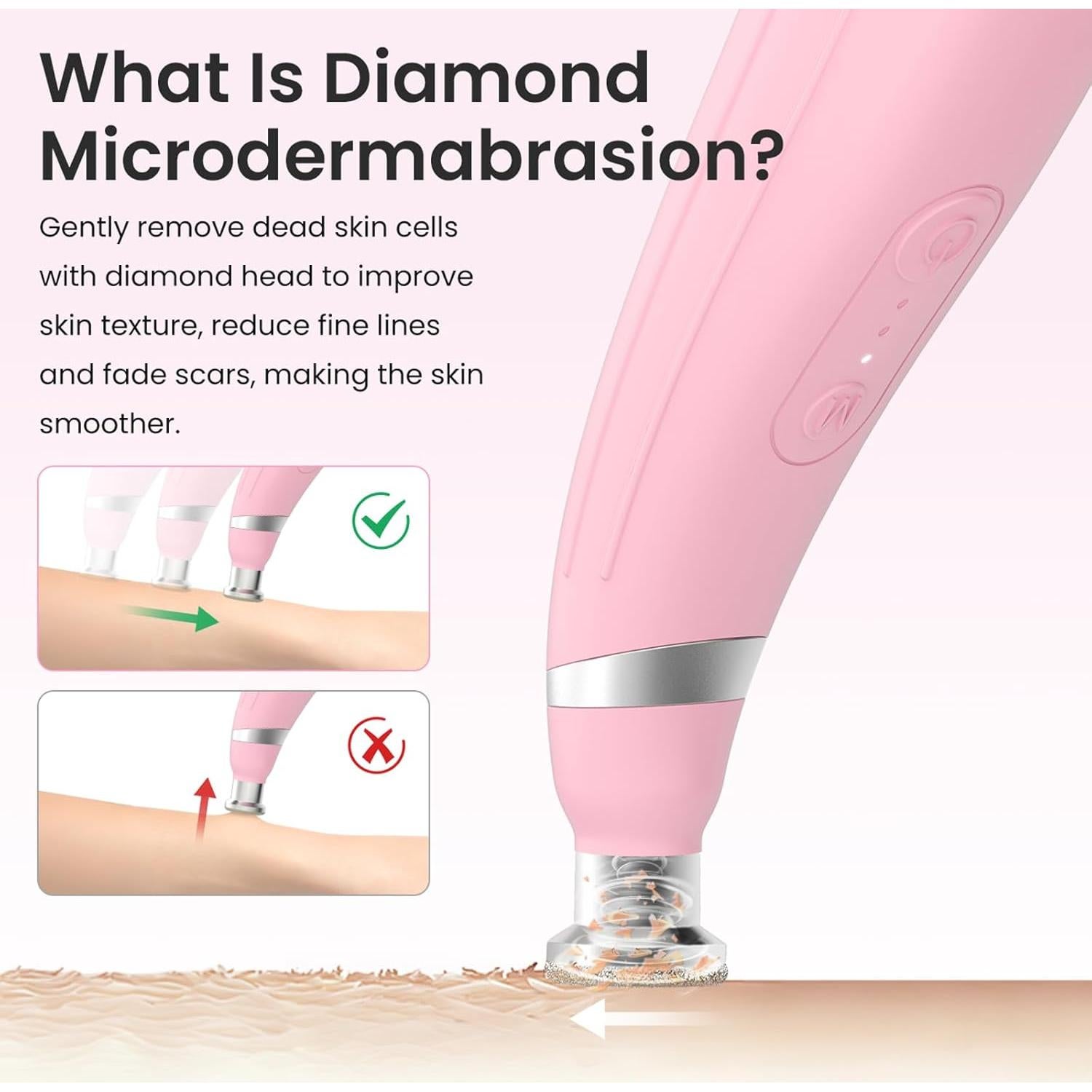 Máquina de Microdermoabrasión UNOISETION Rosa Inalámbrica