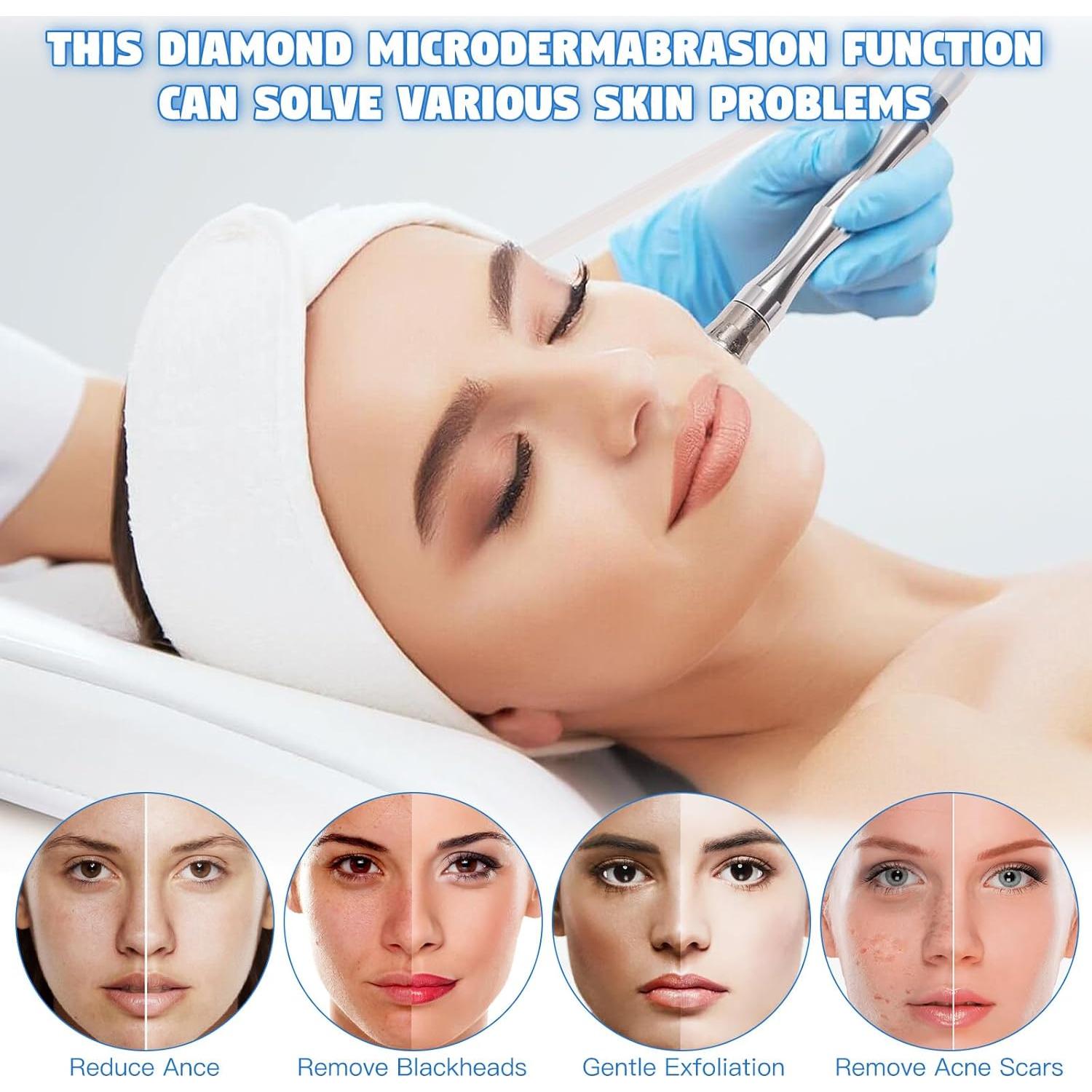 Máquina de Microdermoabrasión 2 en 1 Beauty Star - Limpieza Facial Profesional