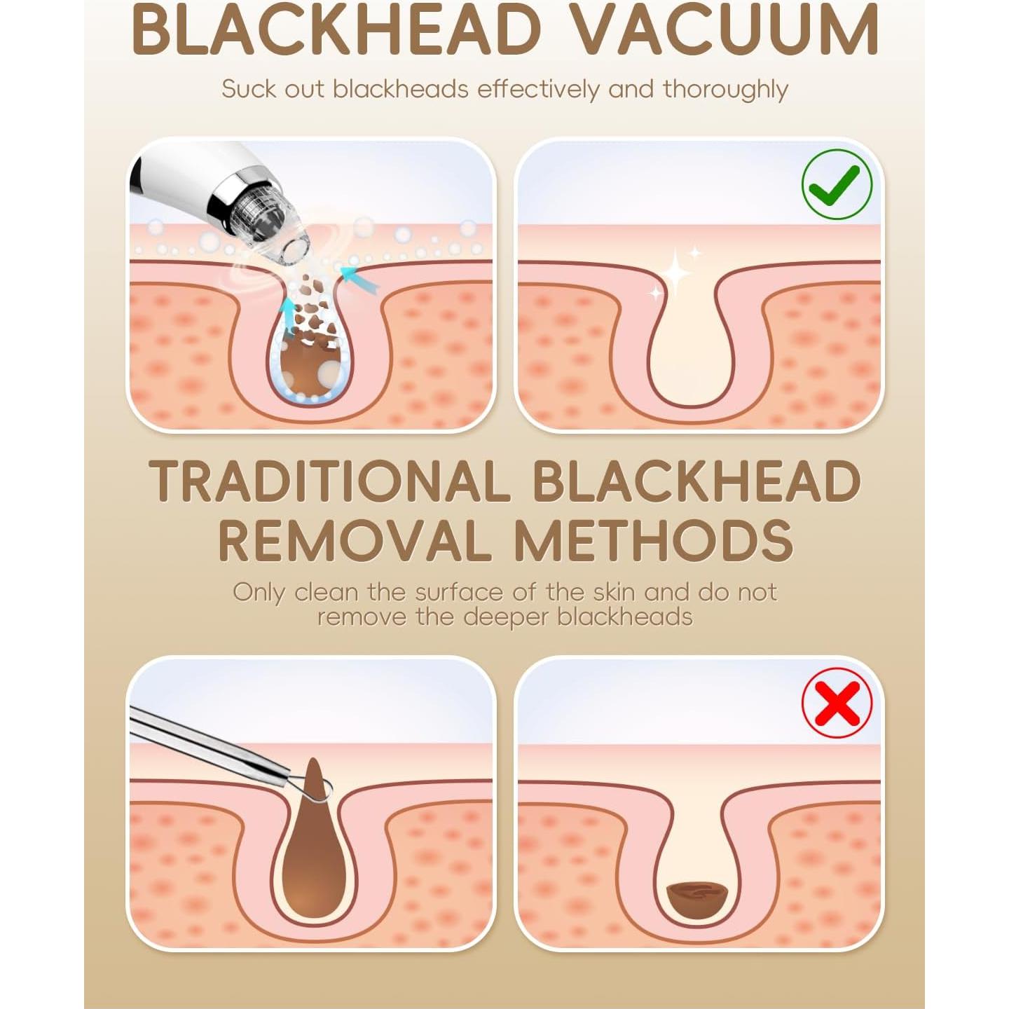 Removedor de Puntos Negros FLYMOOO Blanco 3 Niveles Succión