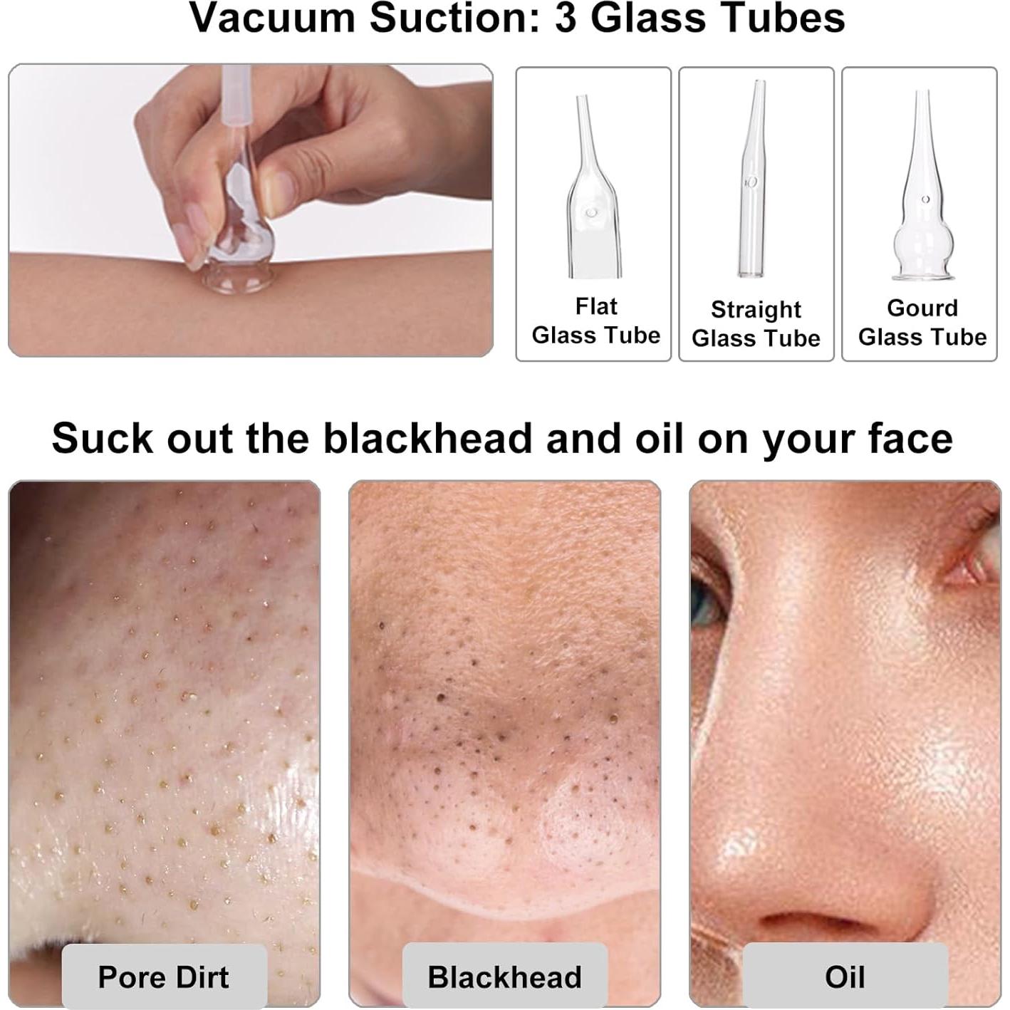 Máquina de Microdermoabrasión 3 en 1 mcwdoit 30,4x23,6cm