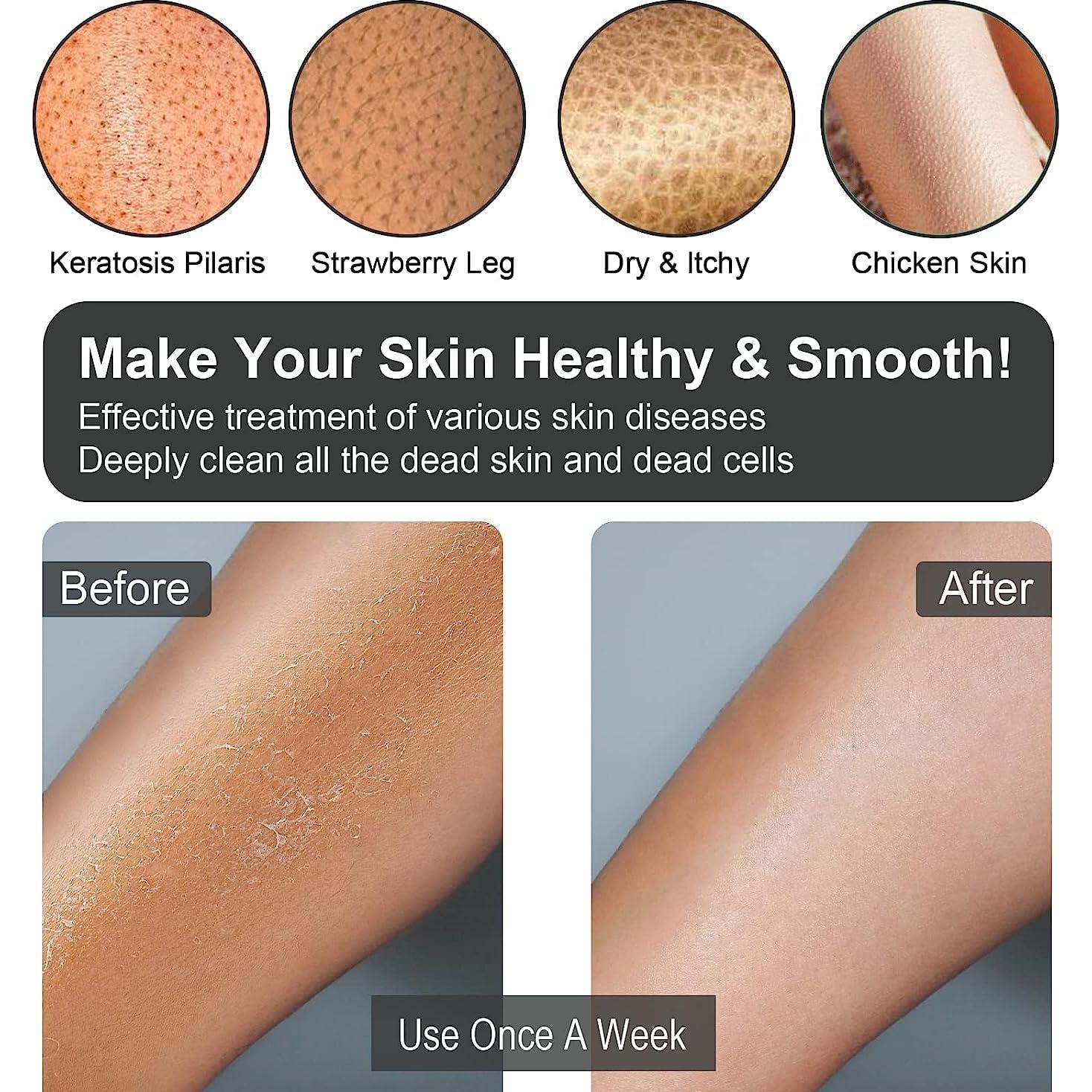 Guantes Exfoliantes Yiclick - Exfoliador Corporal 4 Piezas