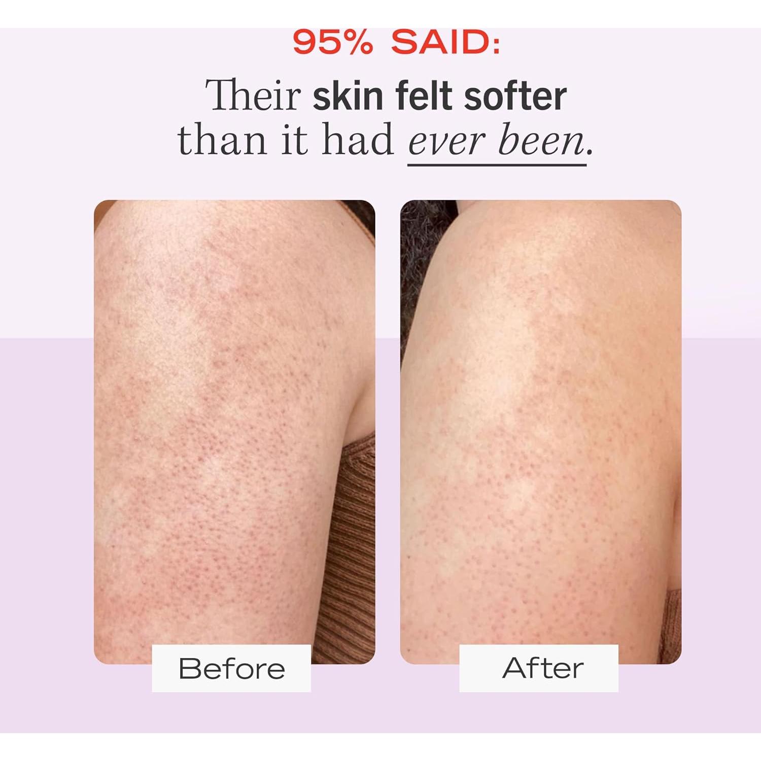 Exfoliante Corporal First Aid Beauty KP Bump Eraser 113 g