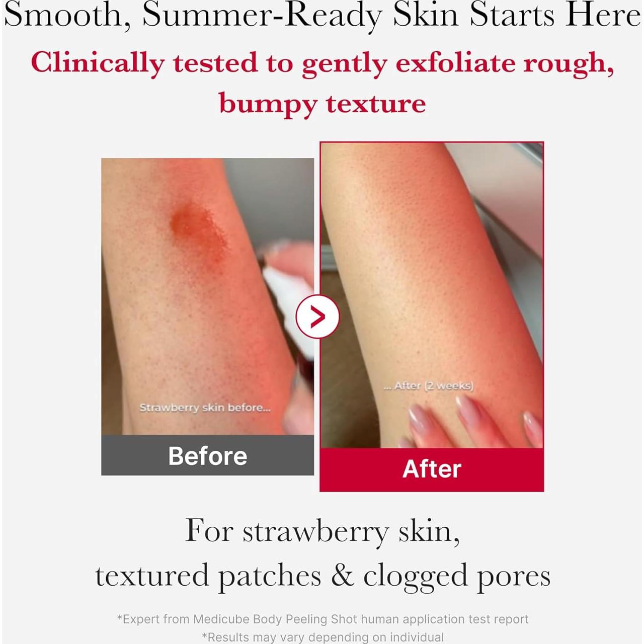 Spray Exfoliante Corporal Medicube Red Peeling 110g AHA BHA