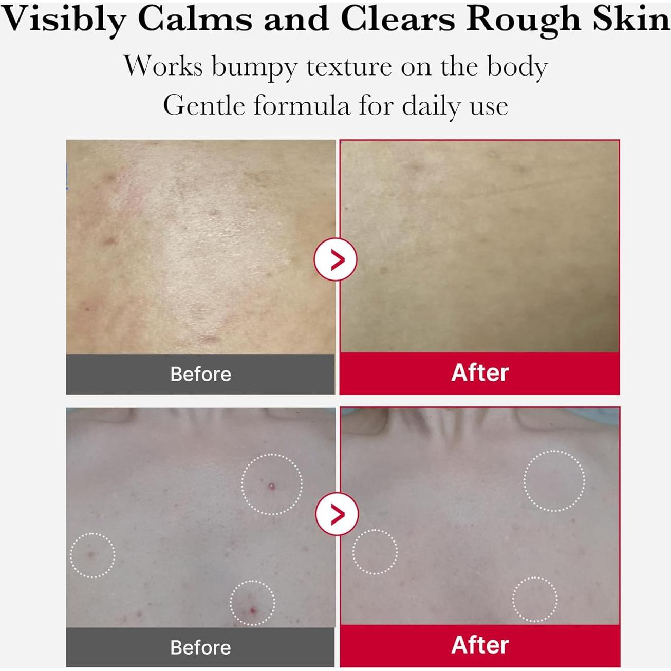 Spray Exfoliante Corporal Medicube Red Peeling 110g AHA BHA