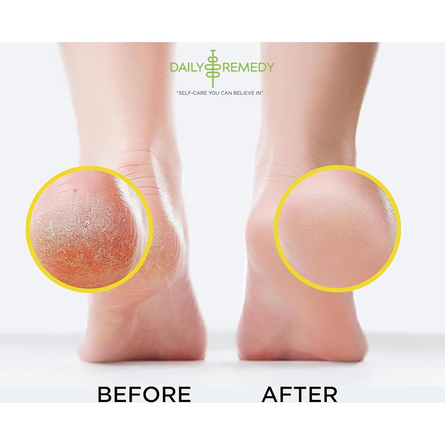 Remojo de Pies Detox Daily Remedy 0.45 kg Cítricos