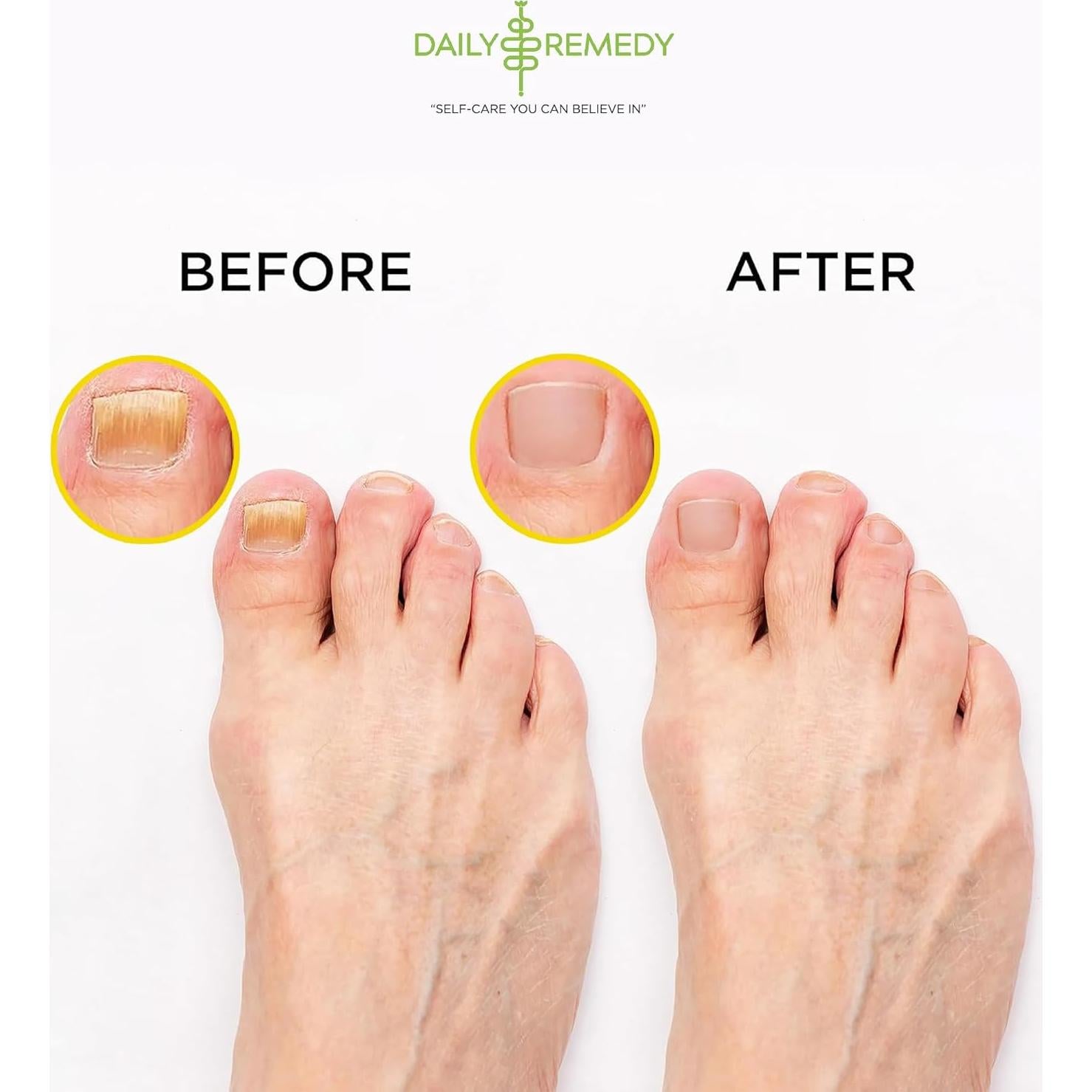 Remojo de Pies Detox Daily Remedy 0.45 kg Cítricos