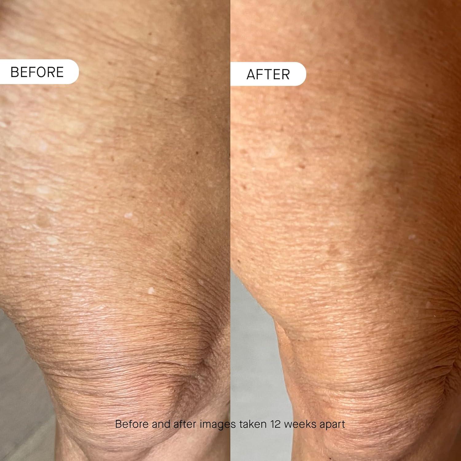 Hidratante Diario de Pétidos OneSkin 310g para Piel Sensible