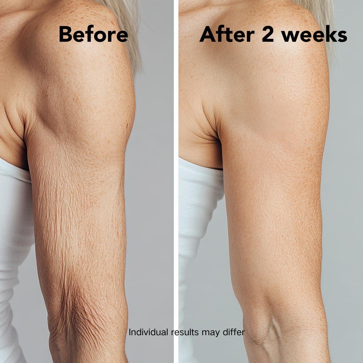 Loción Corporal Reafirmante Retinol 0.05% 300 ml