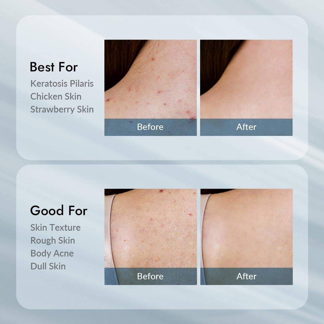 Loción Corporal AHA 12% Coreana 300g Hidratante Exfoliante