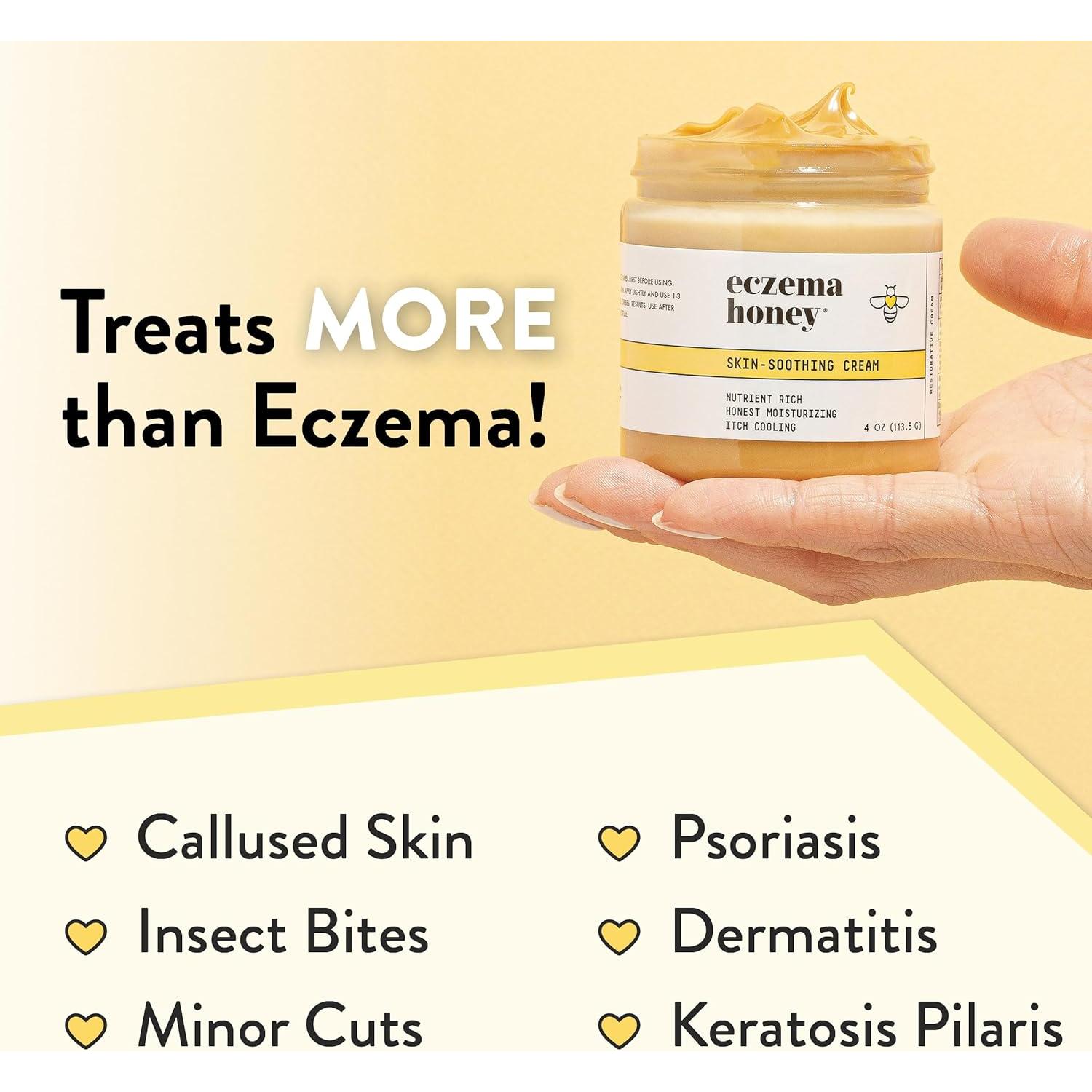 Crema Calmante Eczema Honey 113 g - Alivio Natural Piel Seca