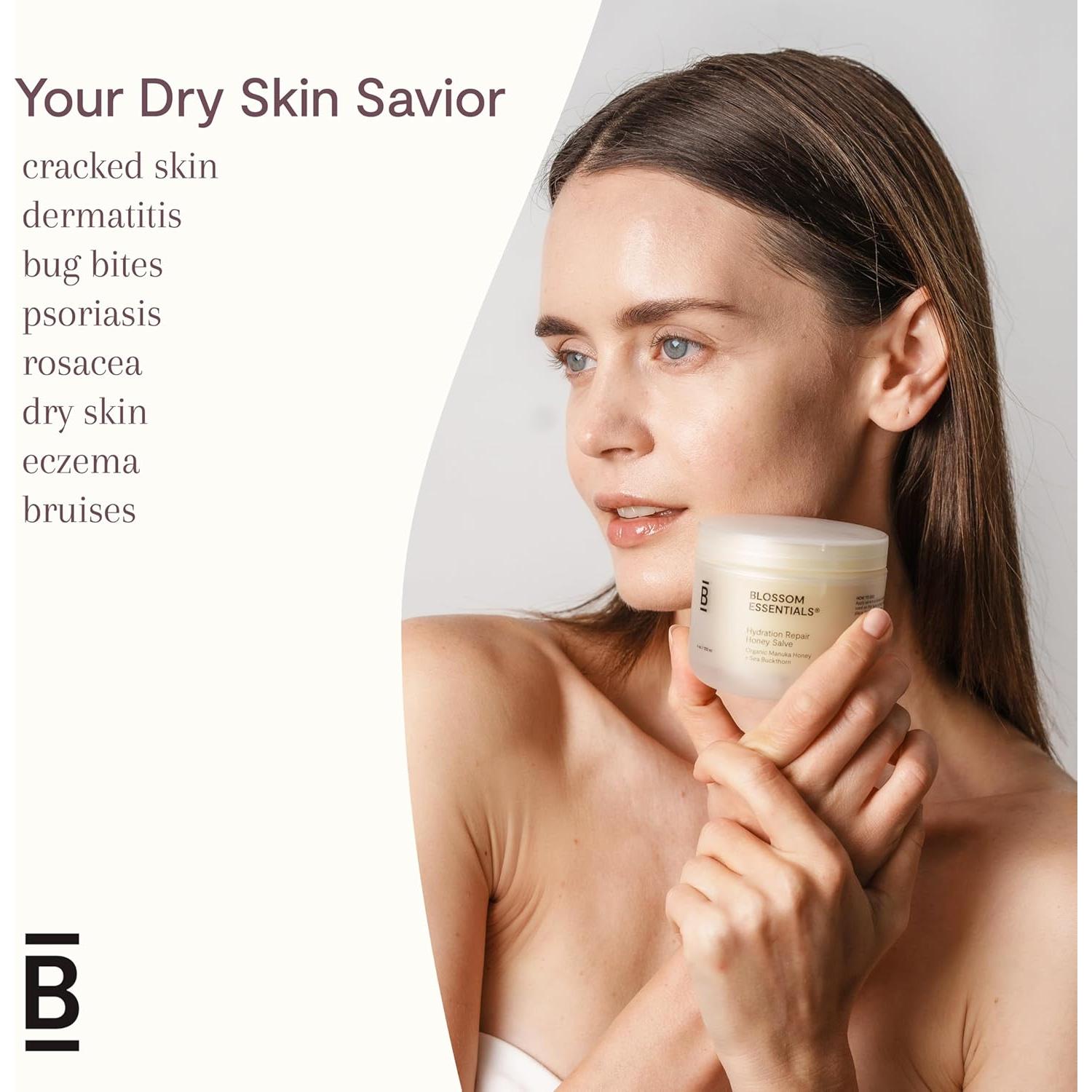 Salve de Miel Blossom Essentials 113g - Hidratante Eczema