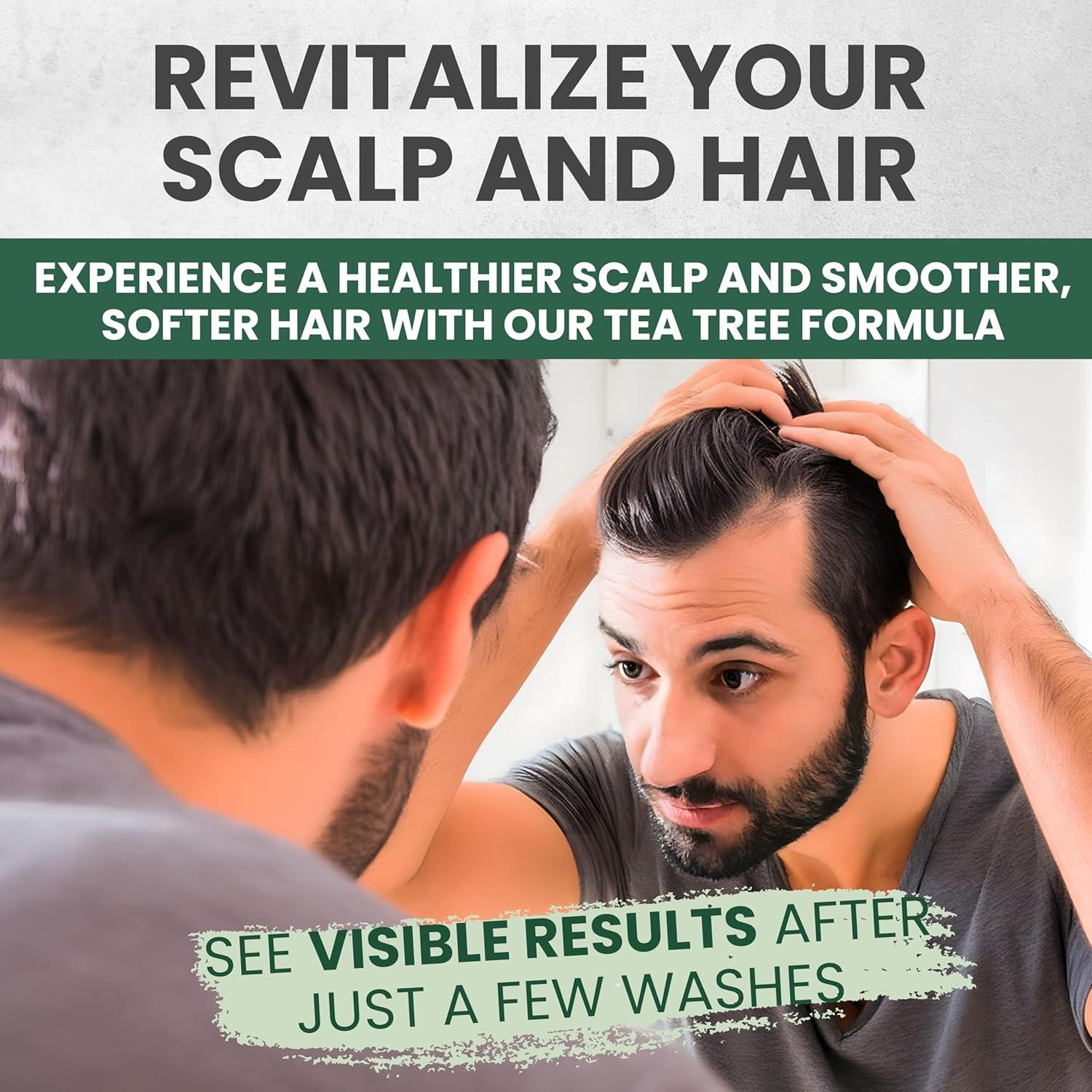 Champú de Aceite de Árbol de Té MaxTherapy 473 ml - Alivio Caspa