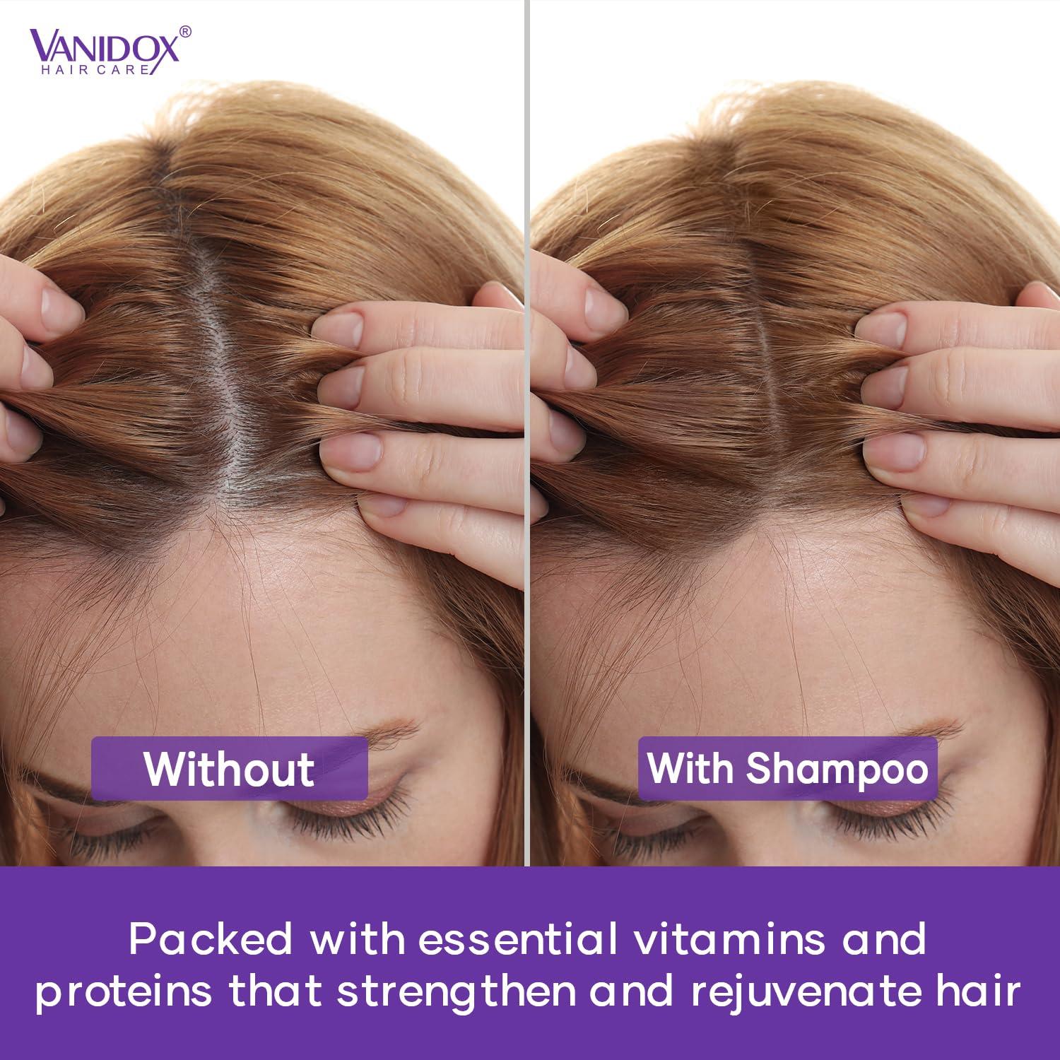 Champú y Acondicionador VANDOX Lavanda y Menta 473 ml