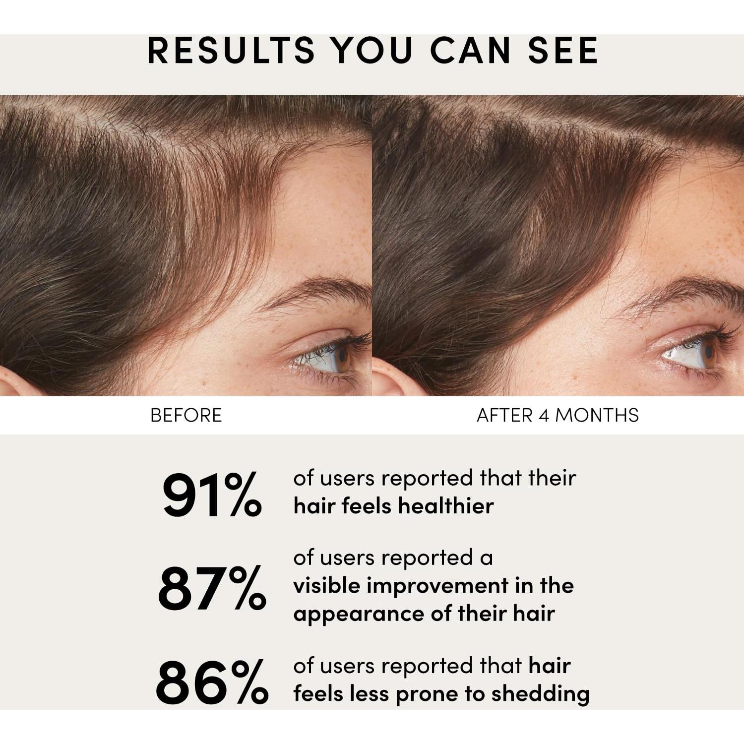 Suero Equilibrante OUAI para Cuero Cabelludo 60 ml