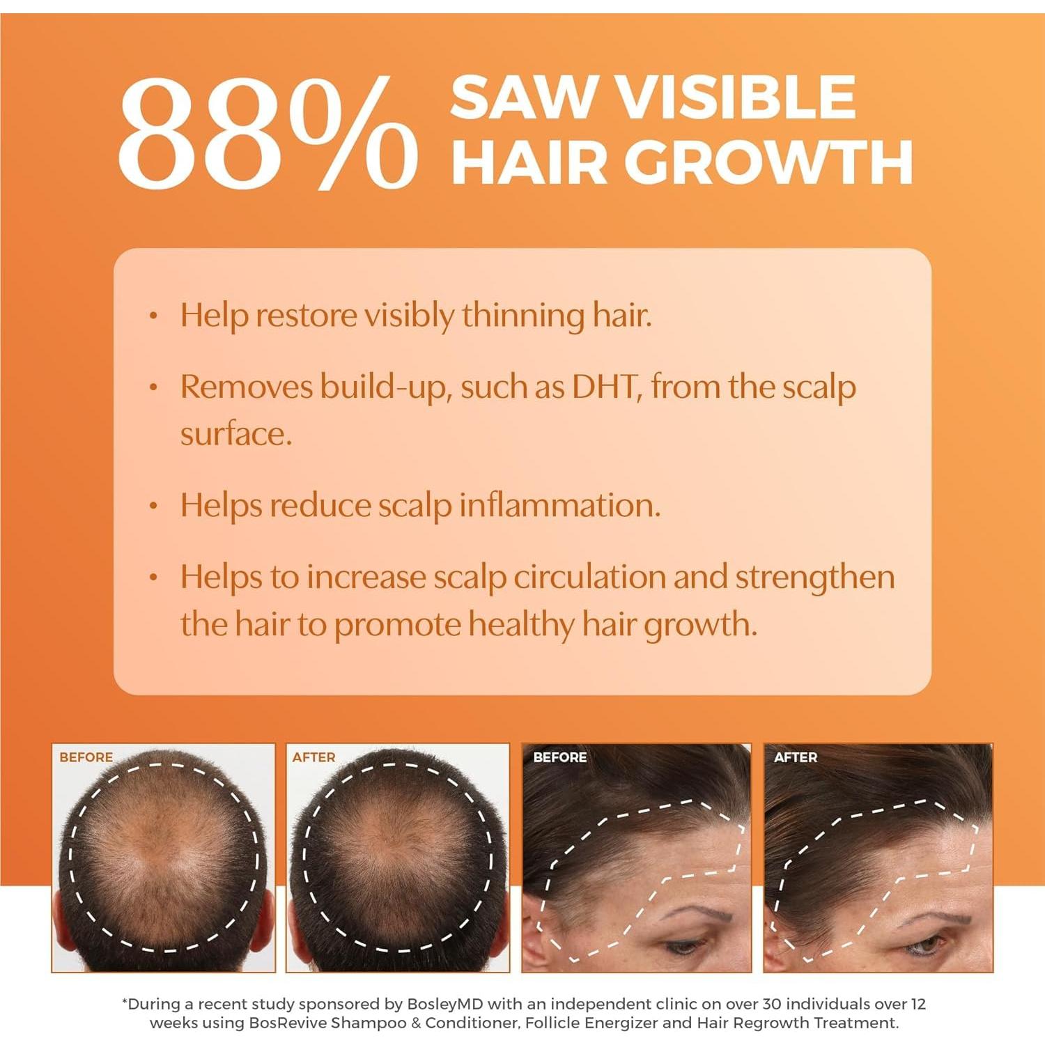 Champú Nutritivo BosRevive 300 ml - Sin Sulfatos, Vegano