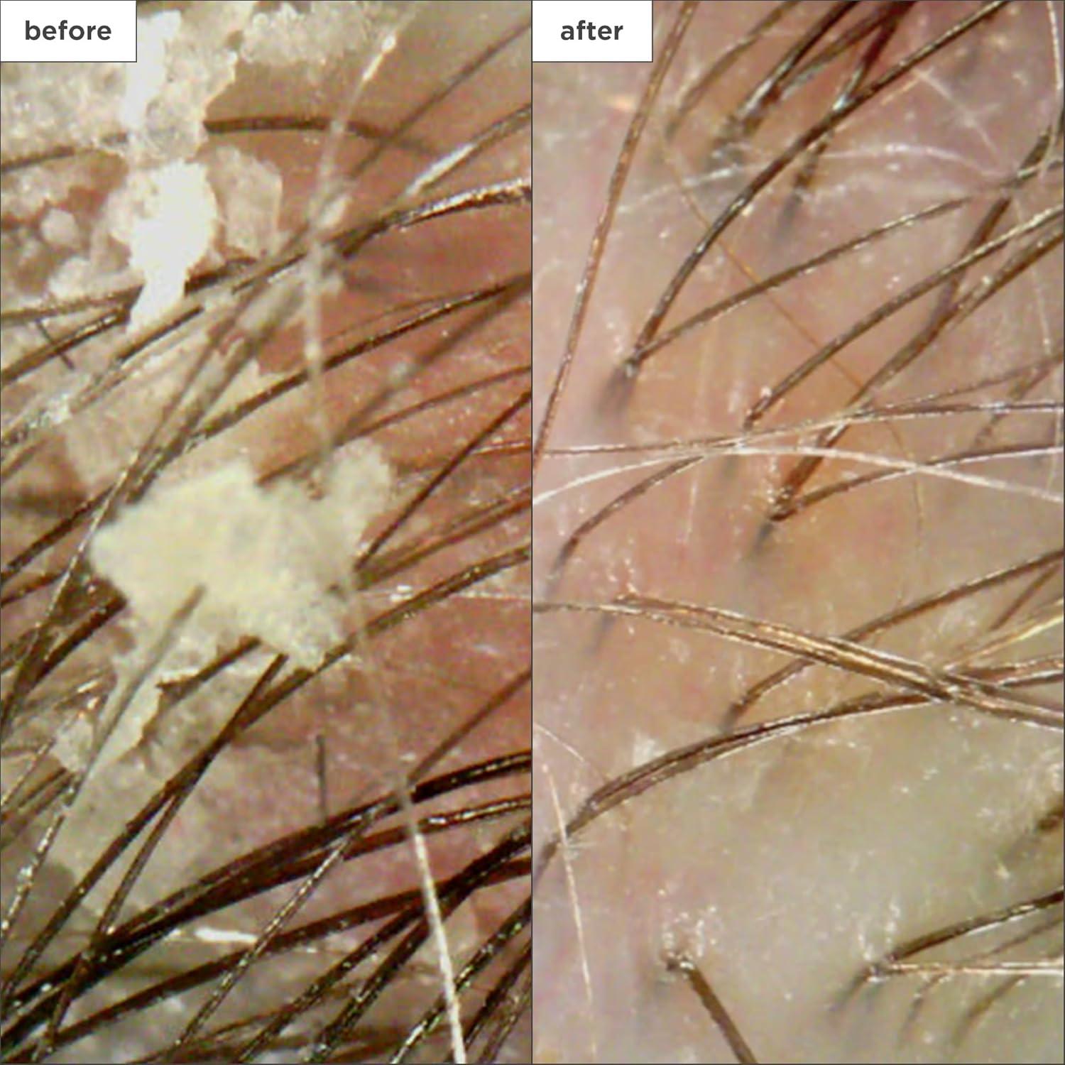 Champú Micro-Exfoliante Briogeo 56.7g Carbón Coco Vegano