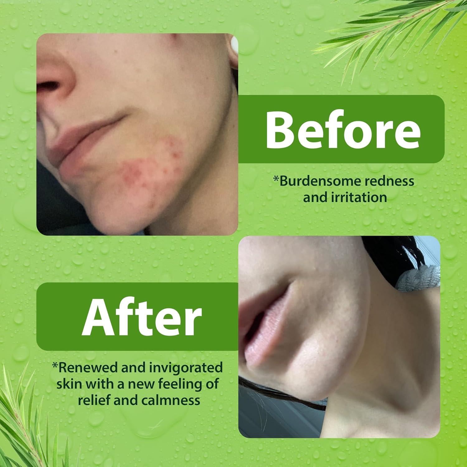 Jabón Corporal Antibacteriano Derma-Nu 236ml Eucalipto